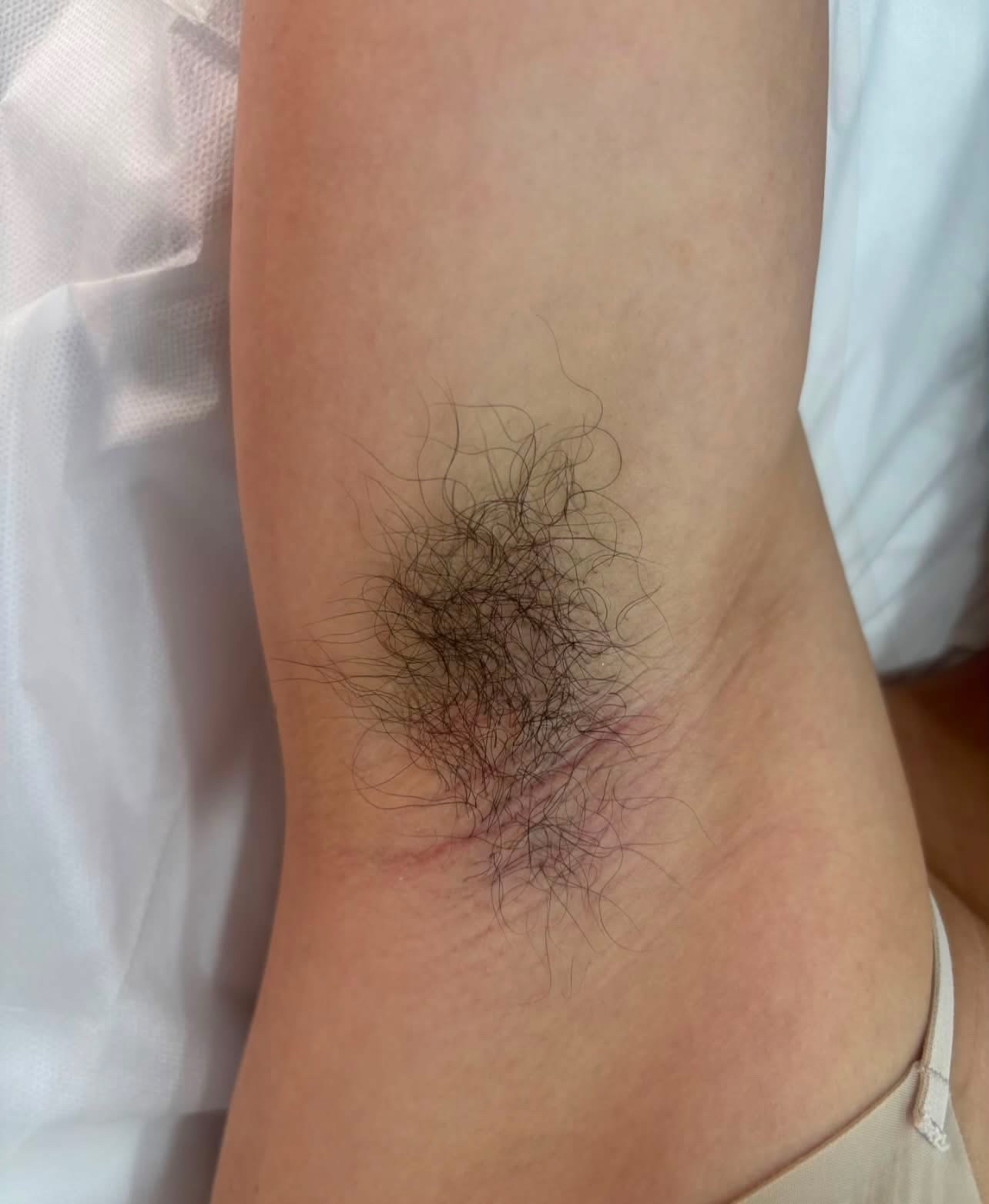 @Women armpit lovers