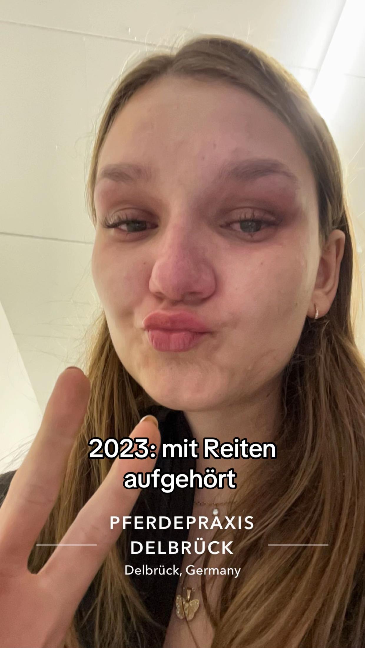 @antoniashlz