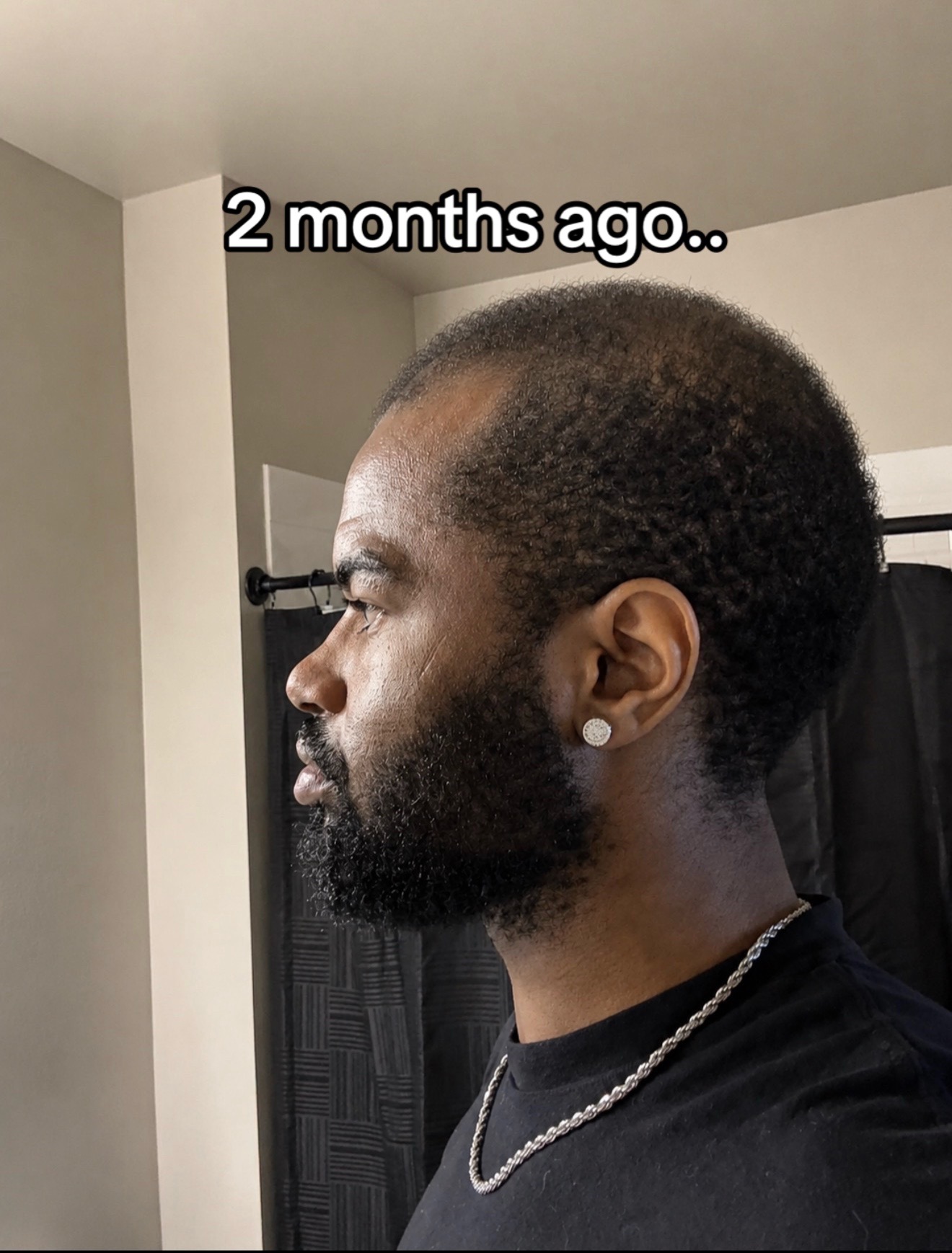 @Imtredarius