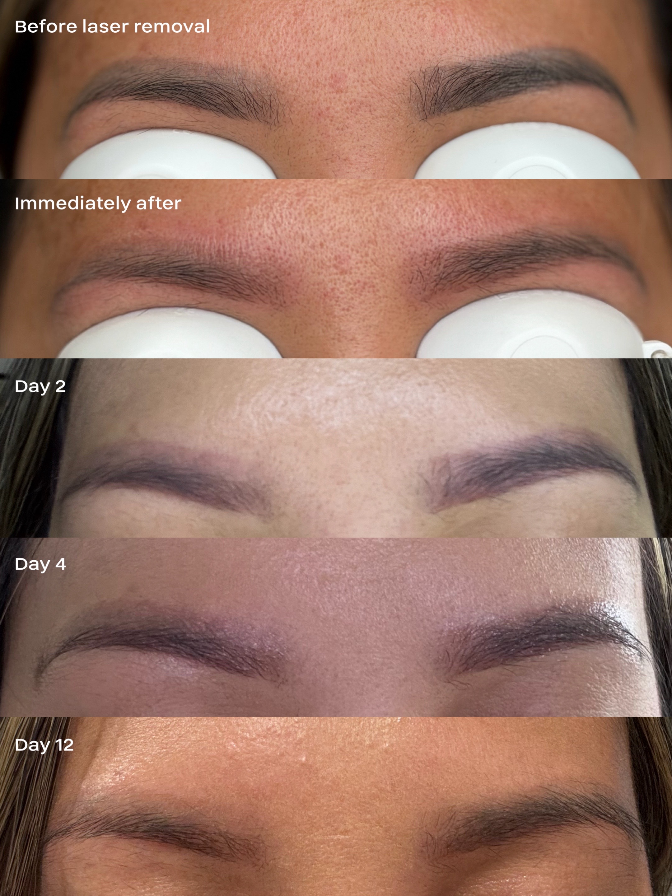 @sisnsisbrows