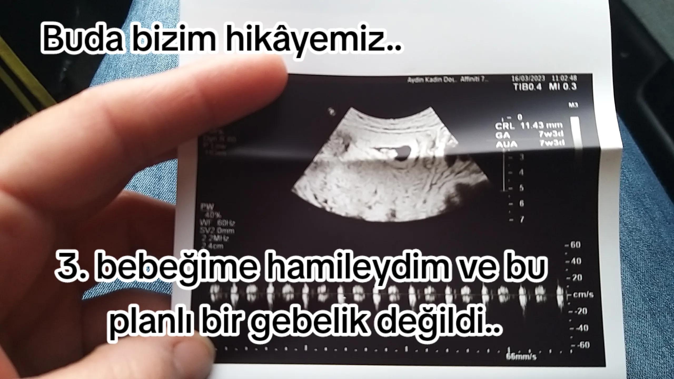 @Tuğba Nur Köroğlu