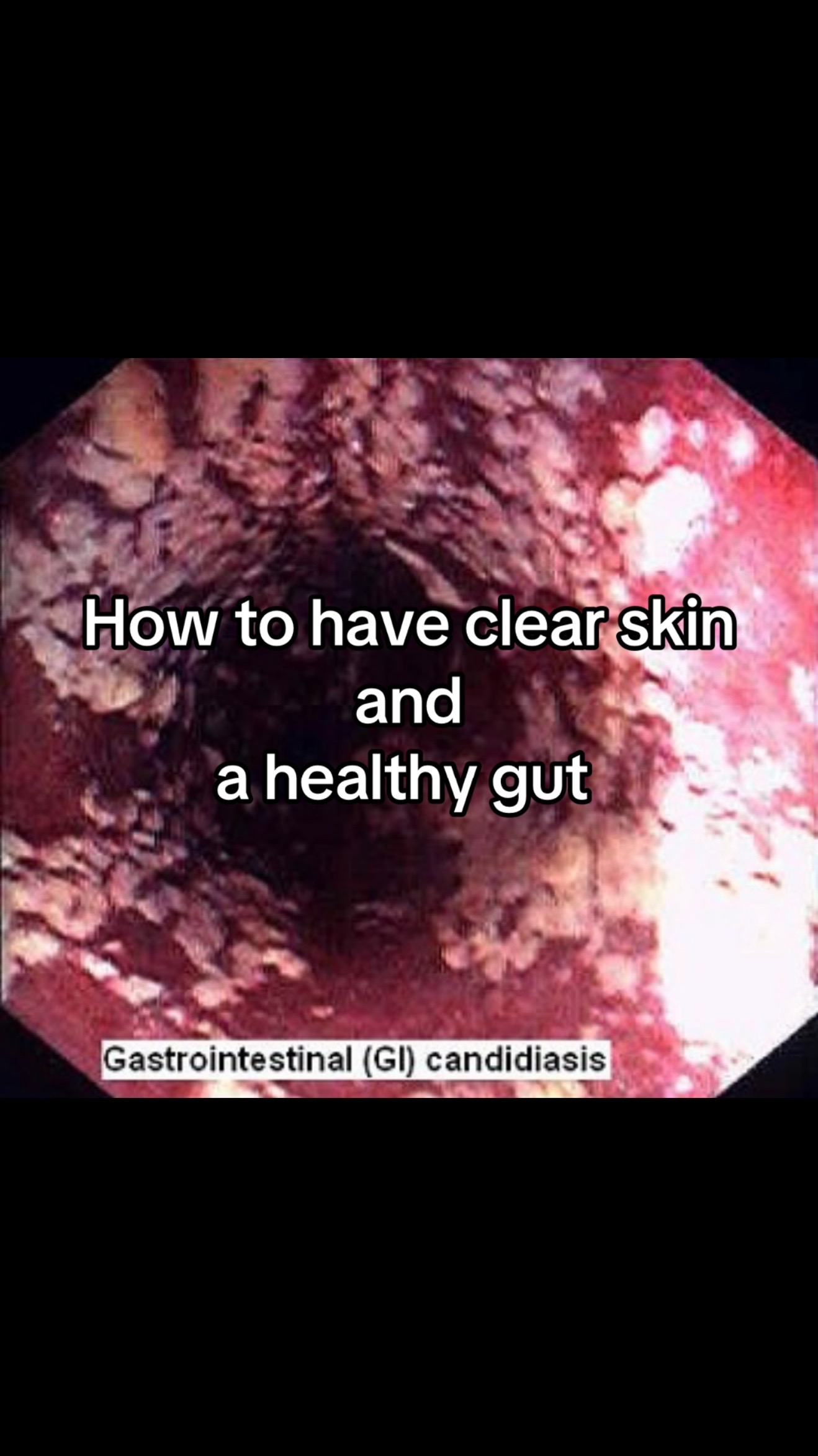 @Gut Health