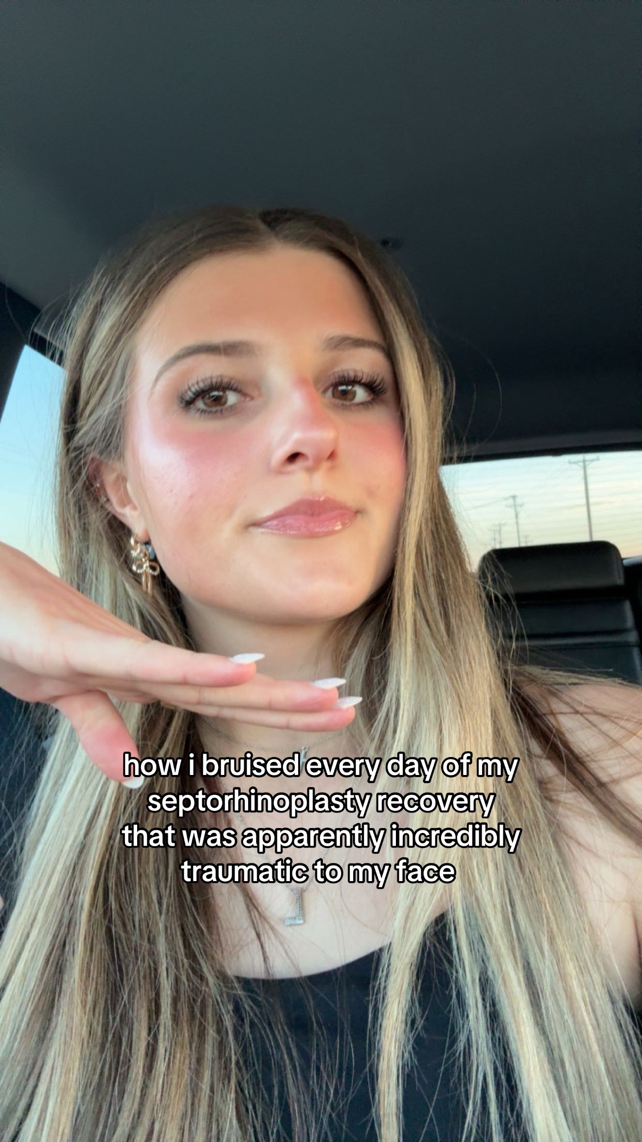 @lily!