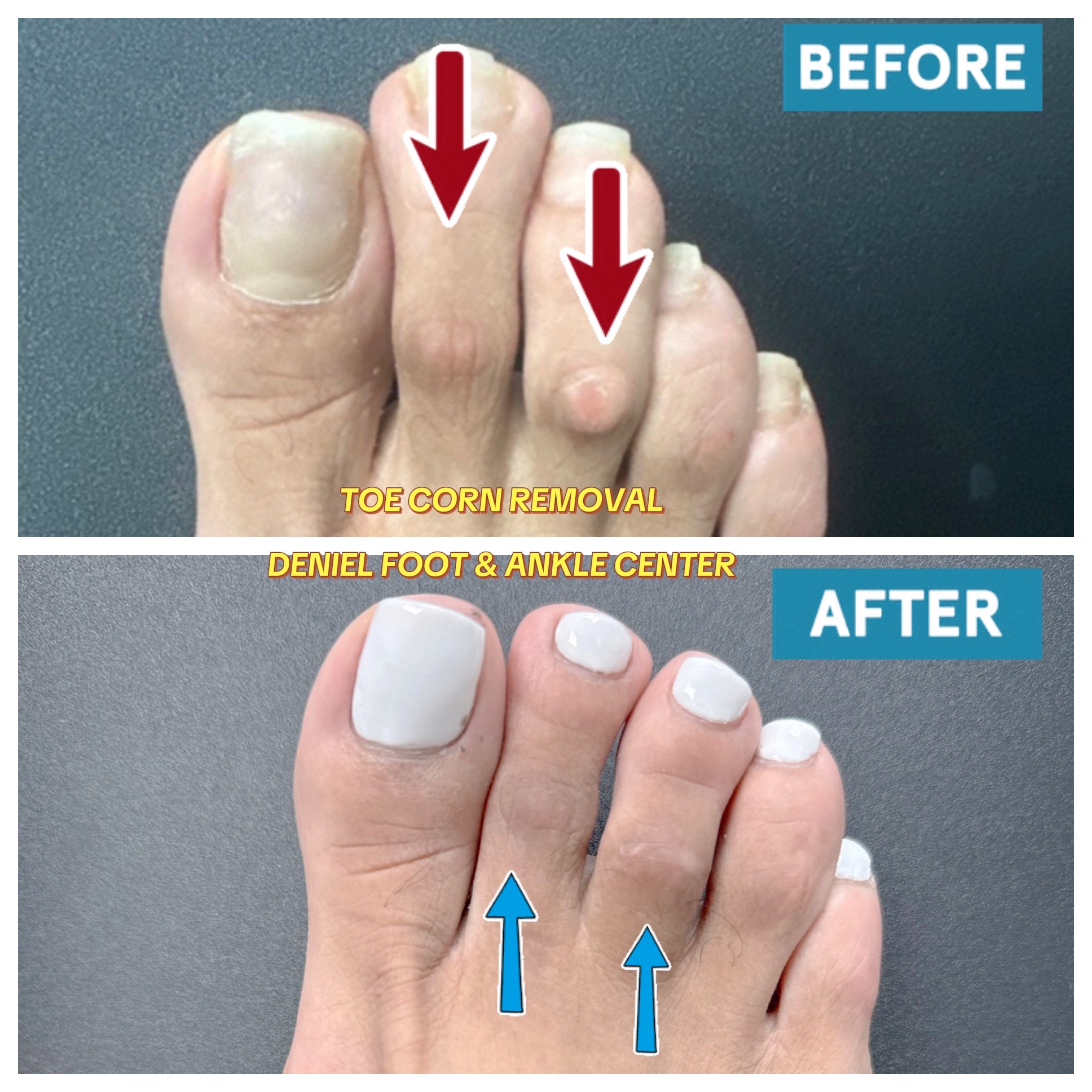 @Deniel Foot and Ankle Center
