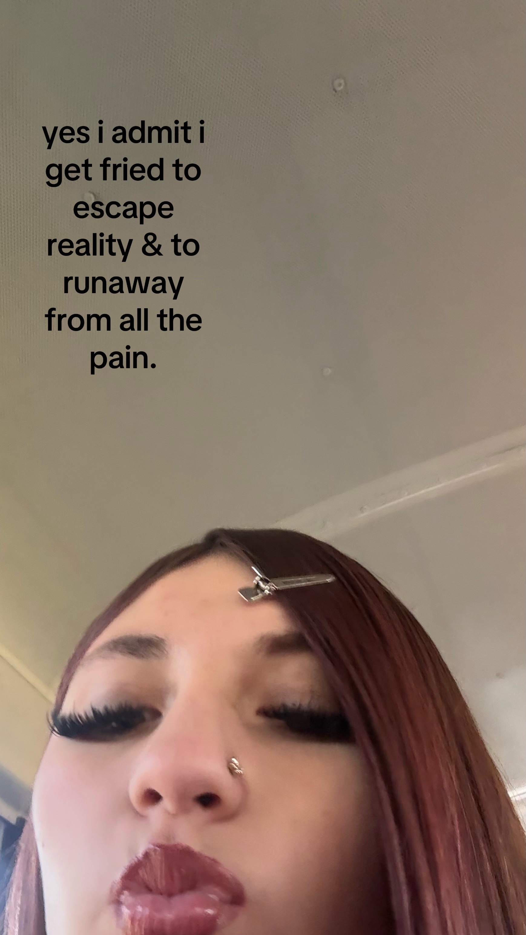 @101