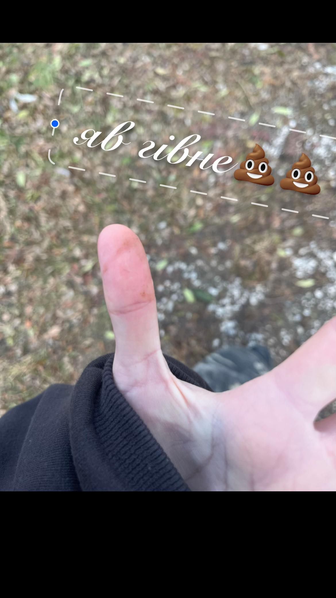 @🧟🧠ארישה
