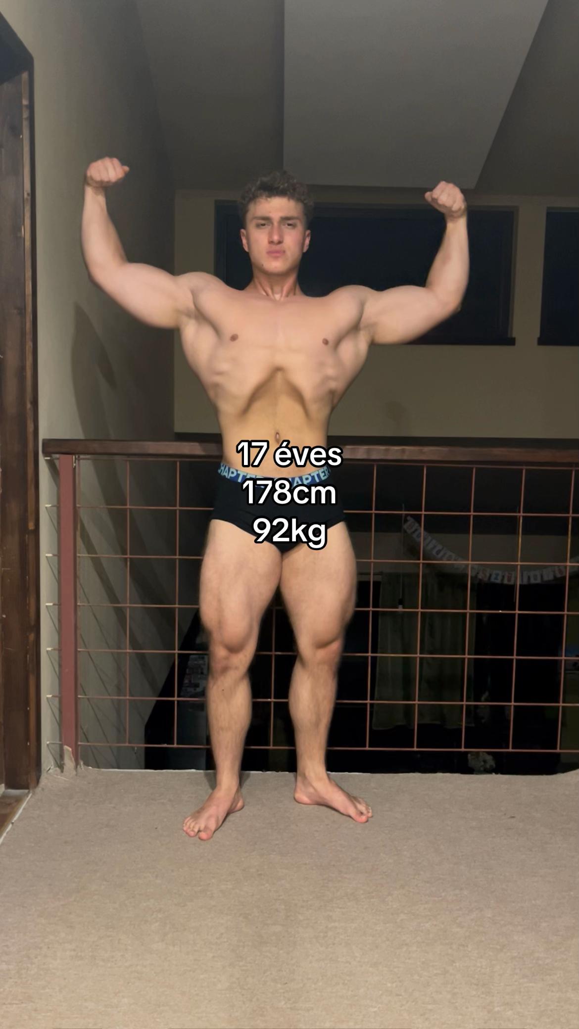 @Kardos Don&aacute;t