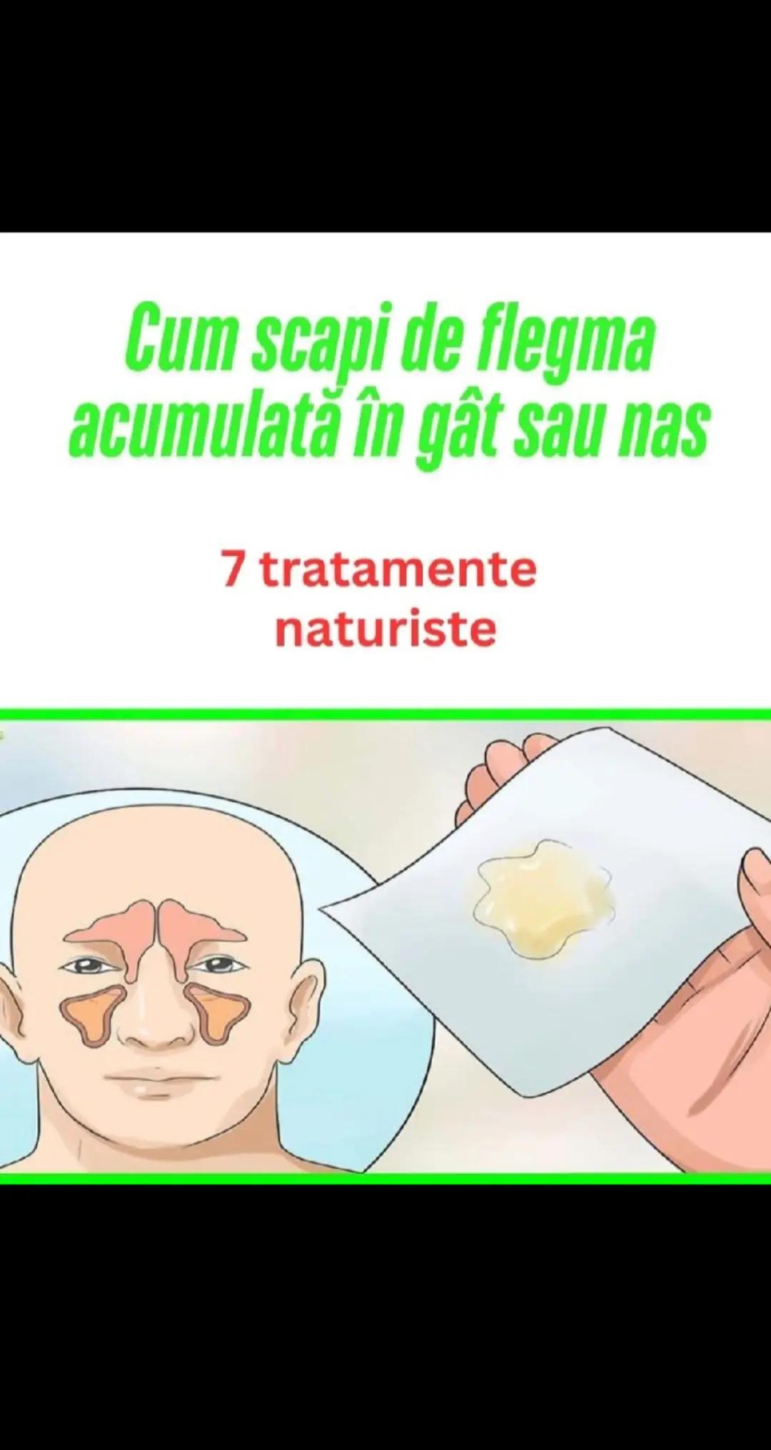 @Ema anton