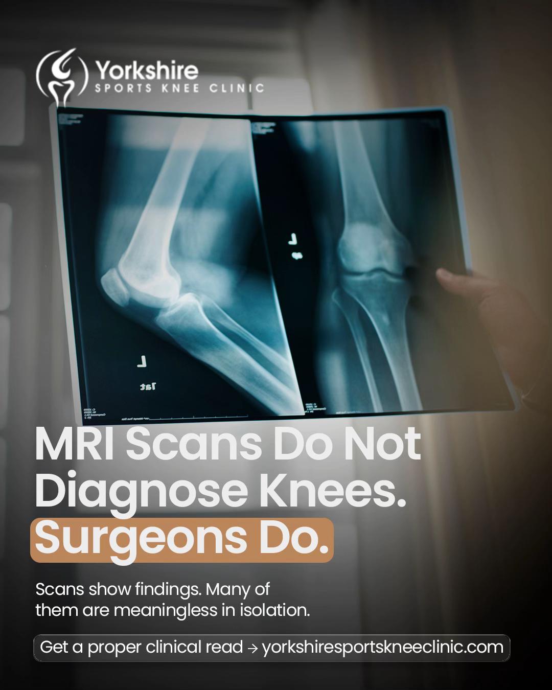@YorkshireSportsKneeClinic