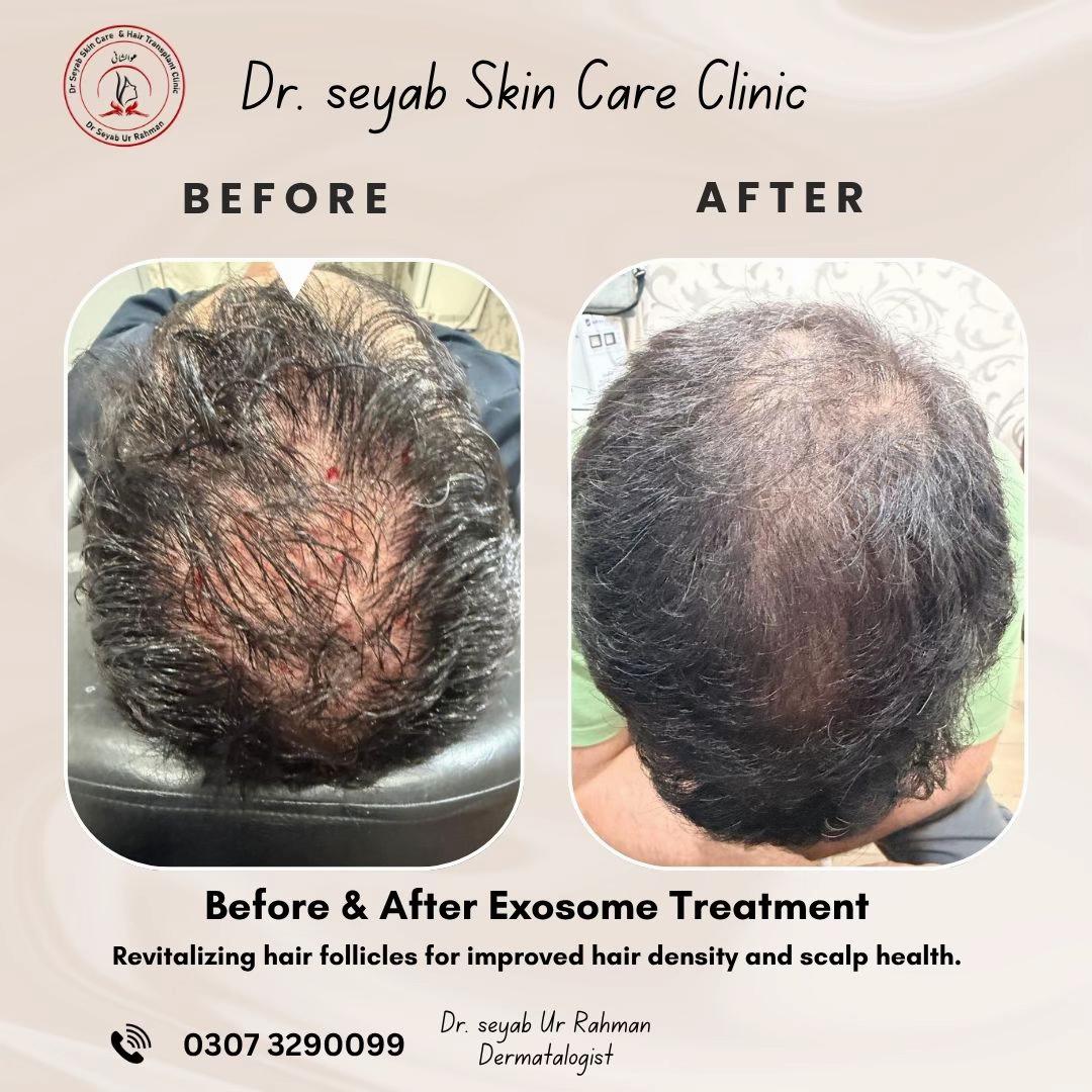 @Dr seyab Dermatologist