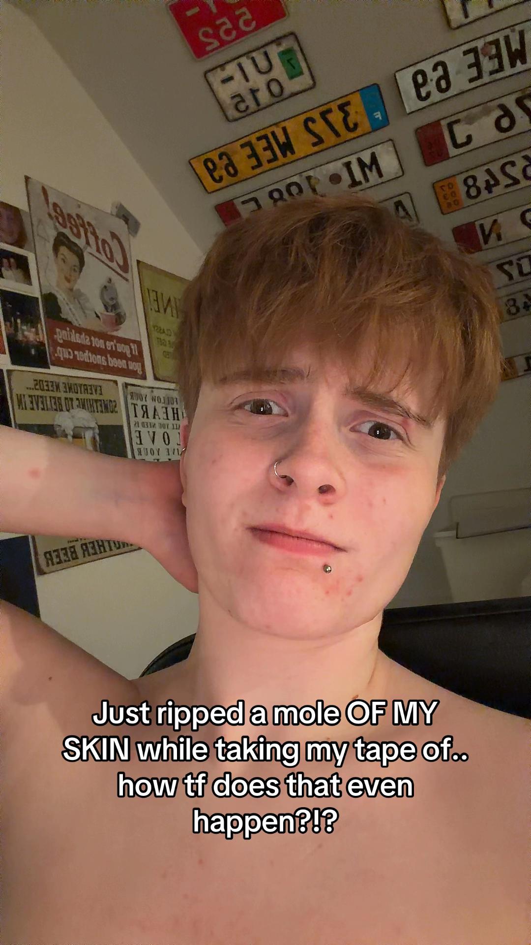 @axel.ftm