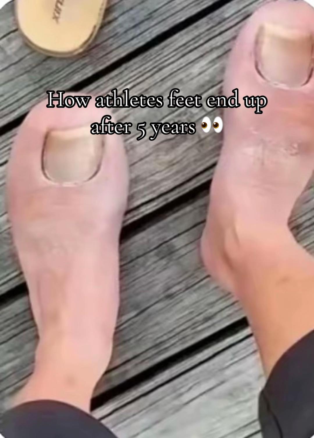 @thenormnal
