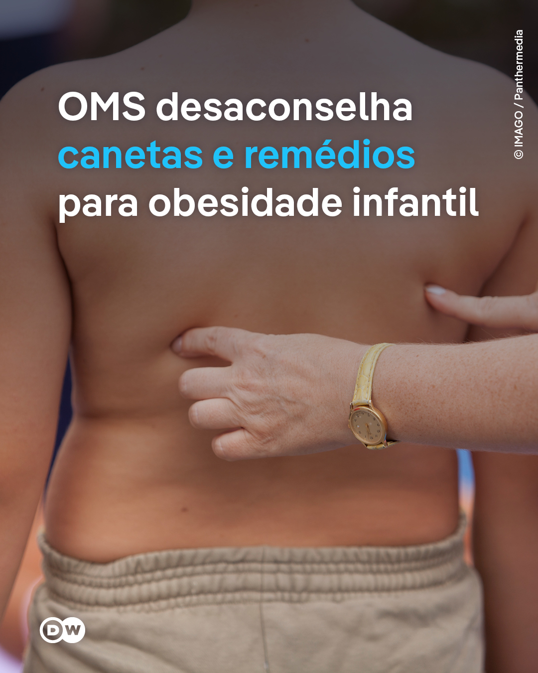 @DW Brasil