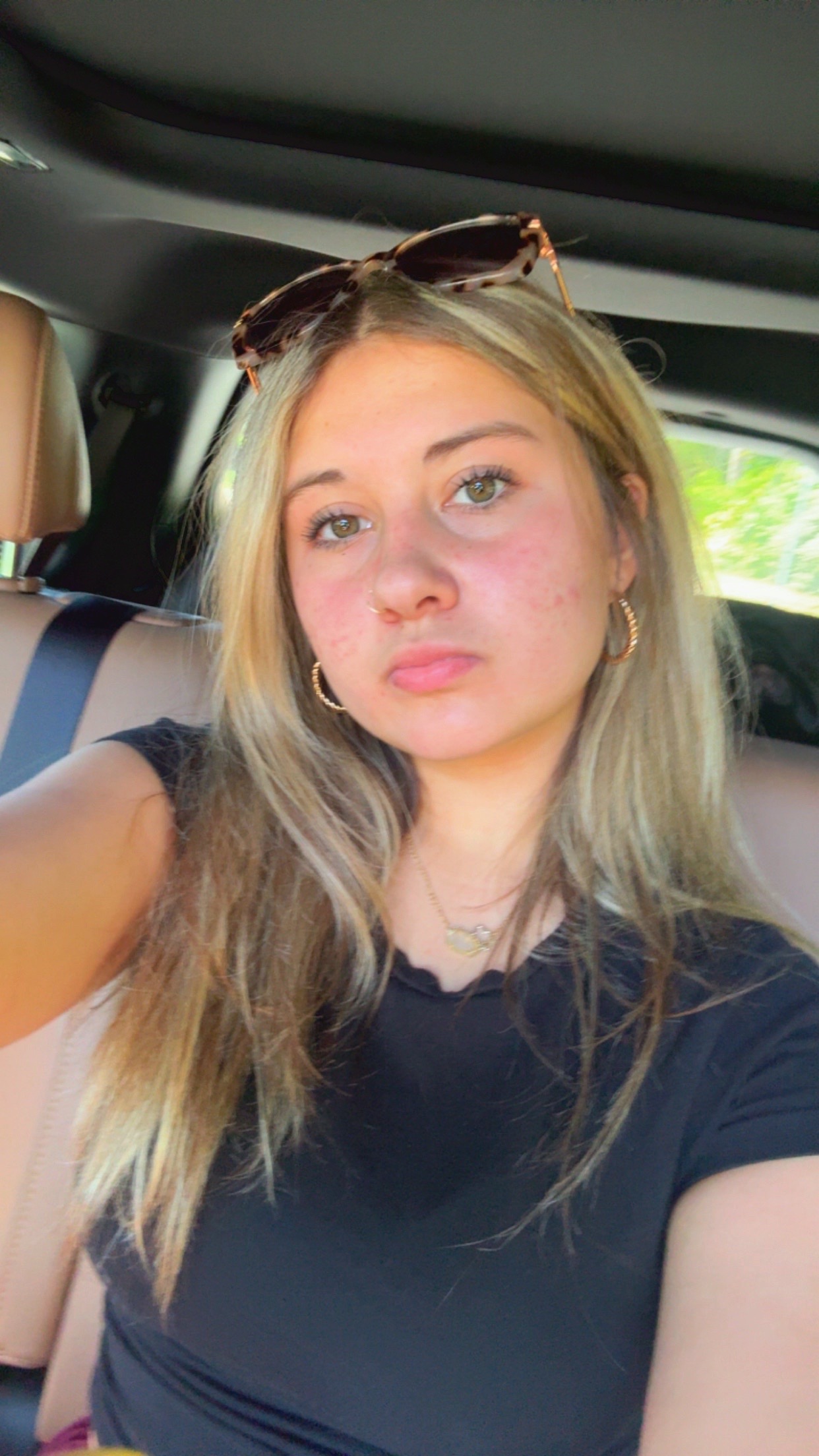 @🍒lly