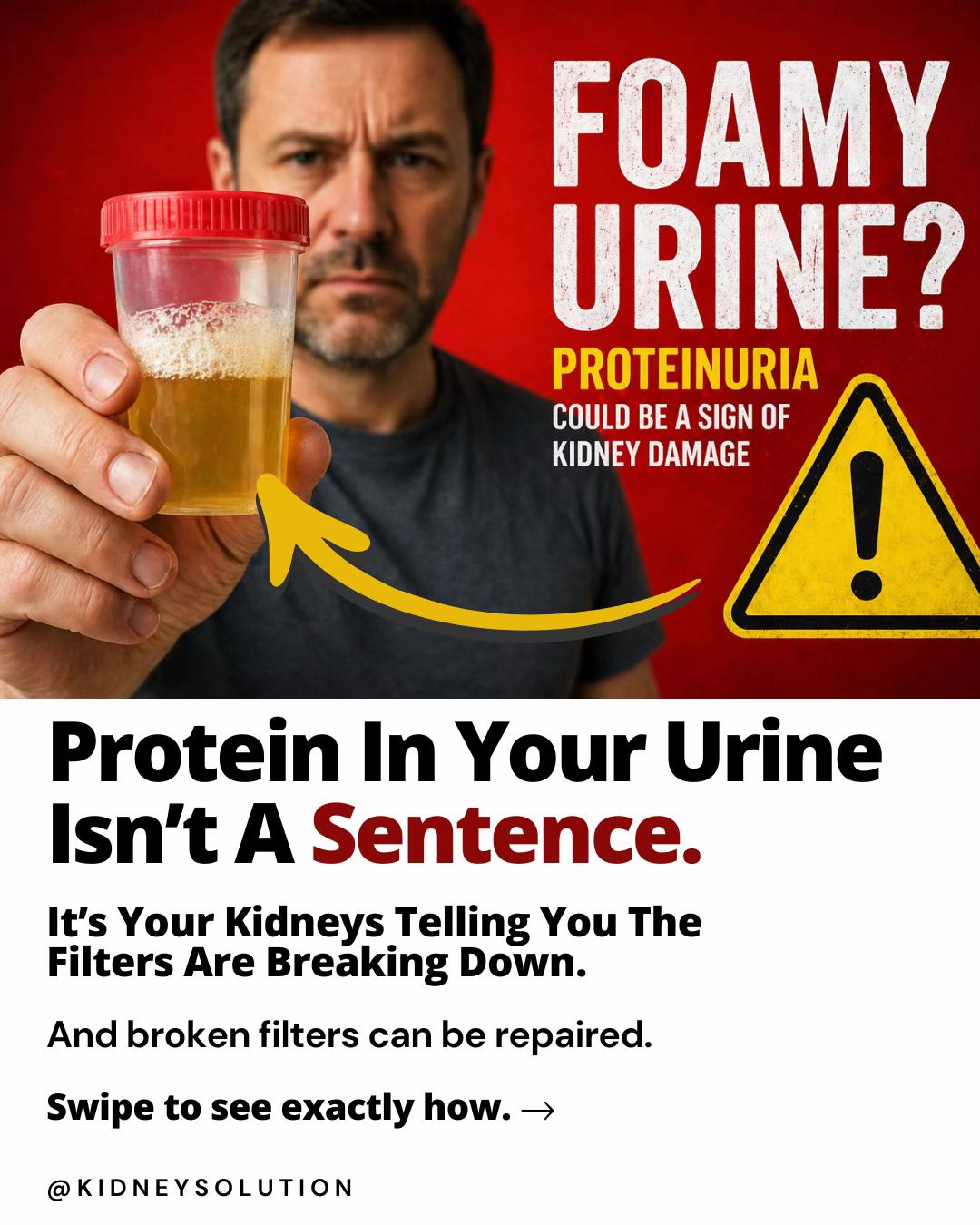 @Kidneysolution