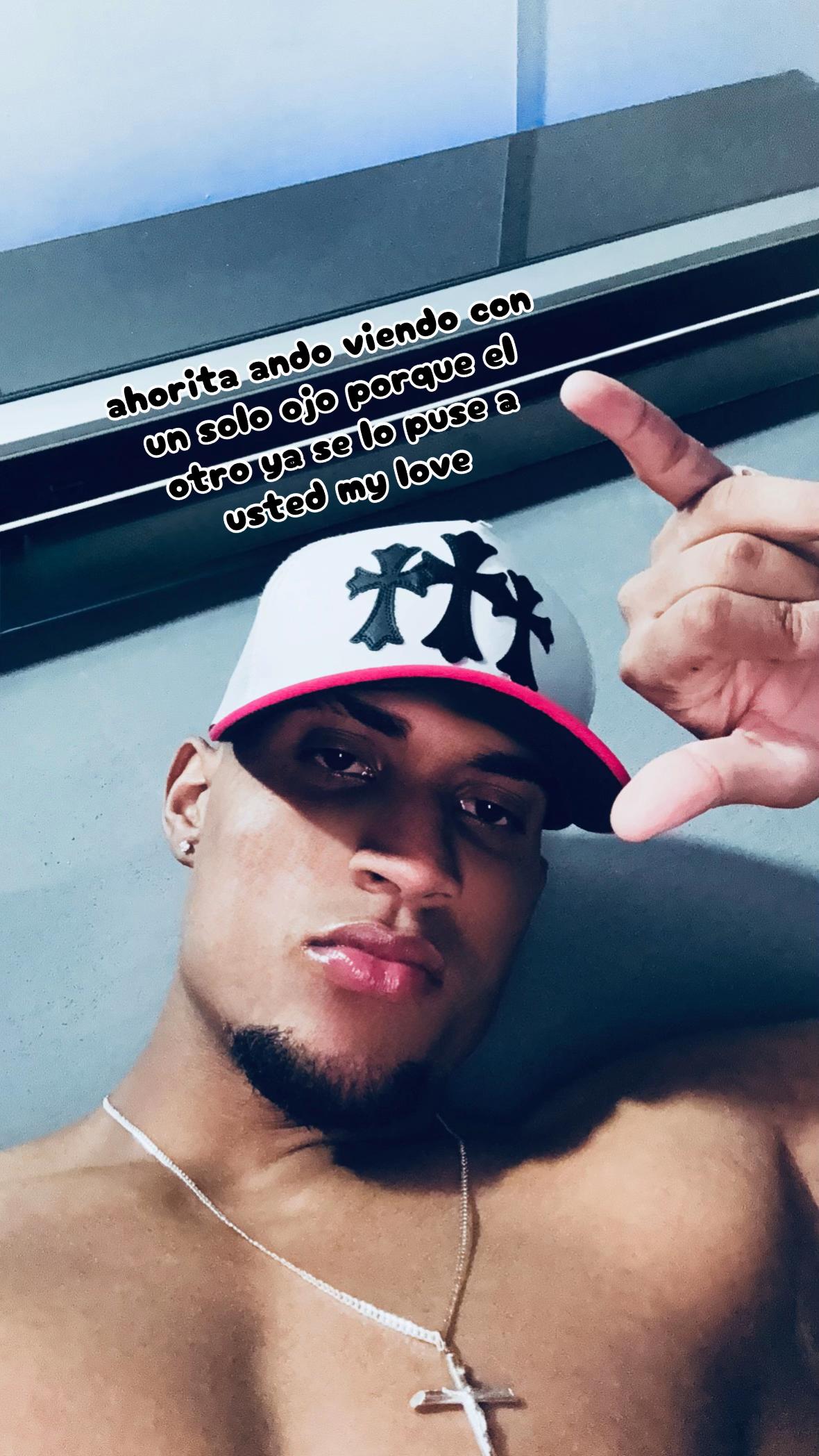 @Luis Ayala