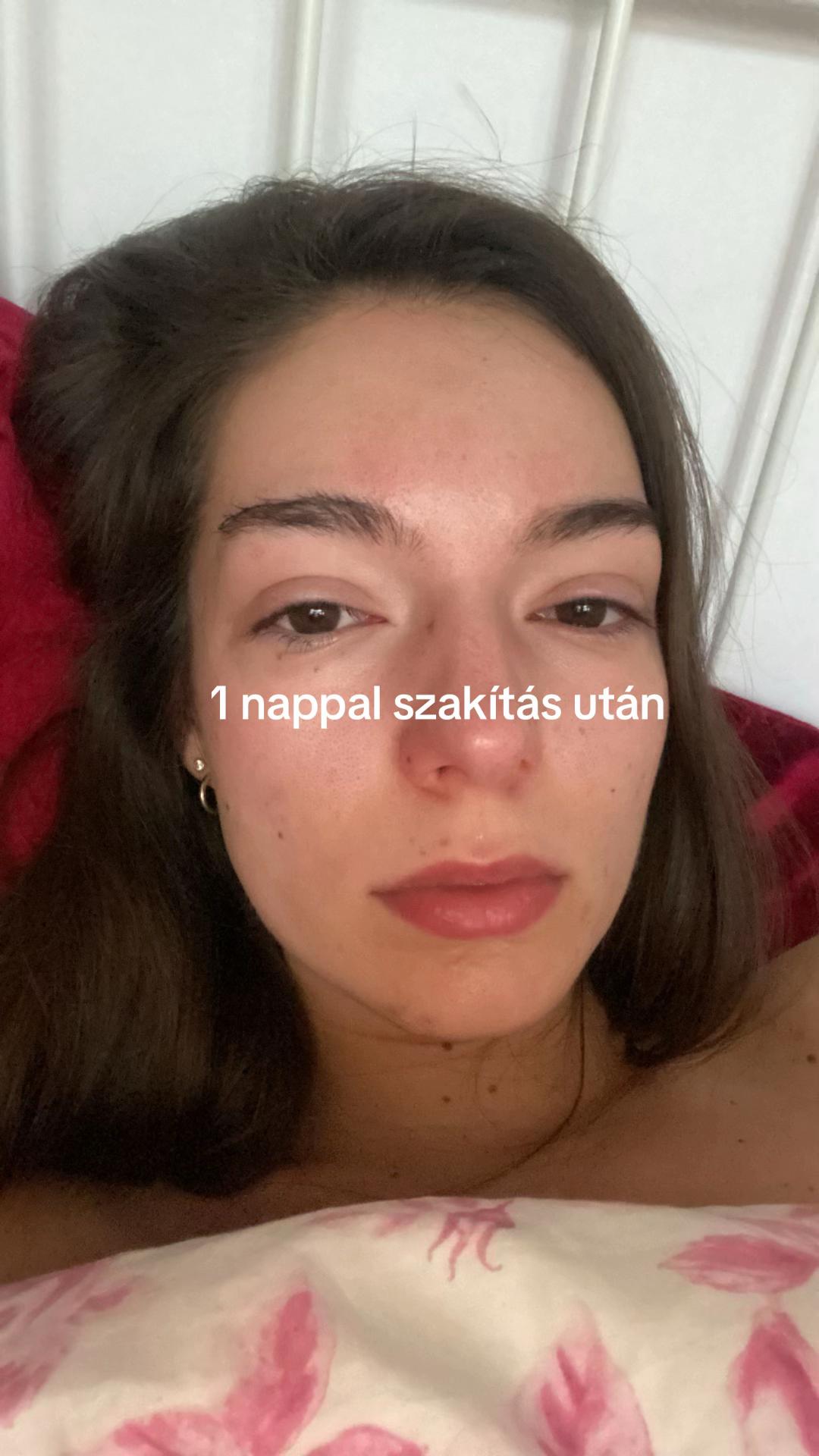 @Blanka