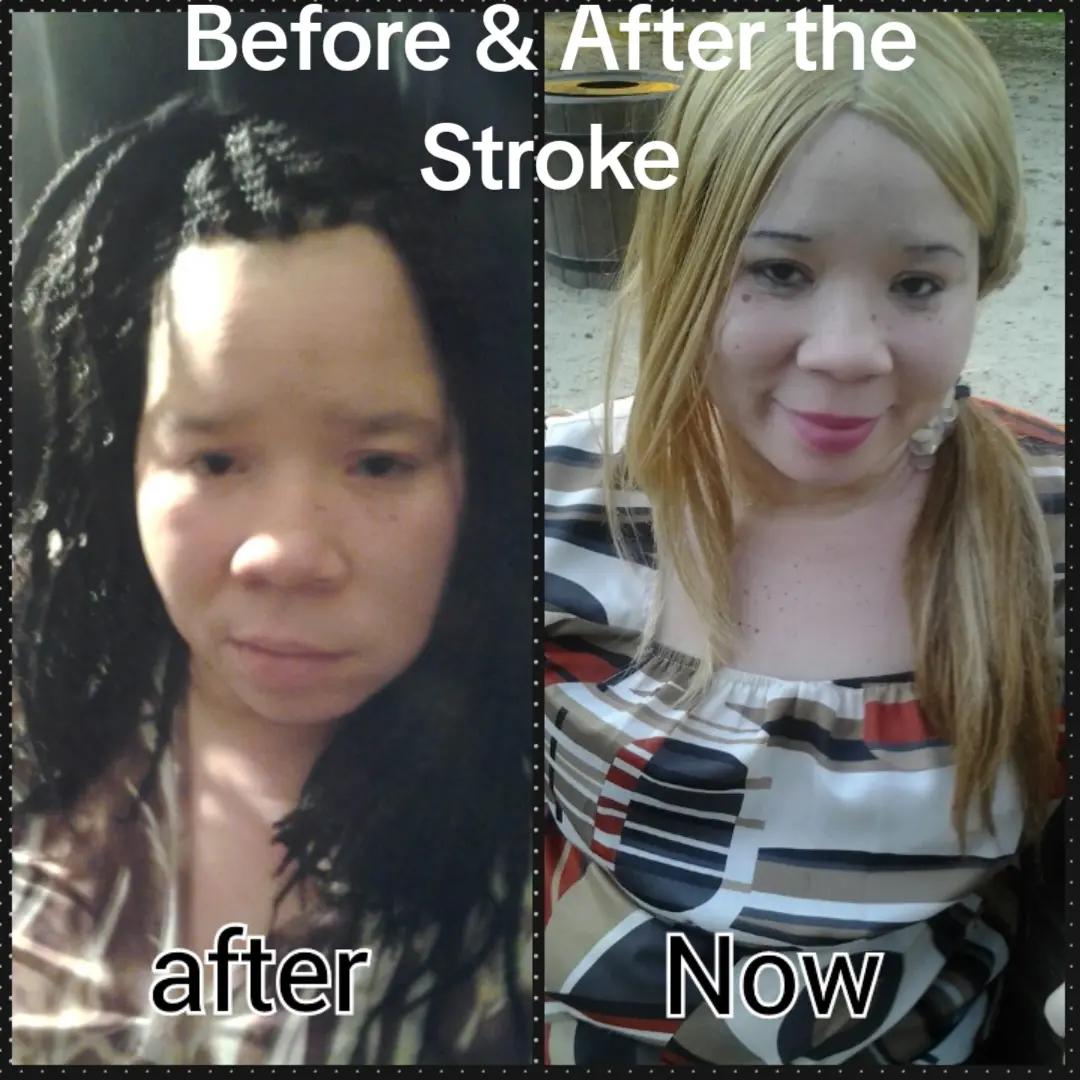 @Miss. PinkY(vitiligo girl)