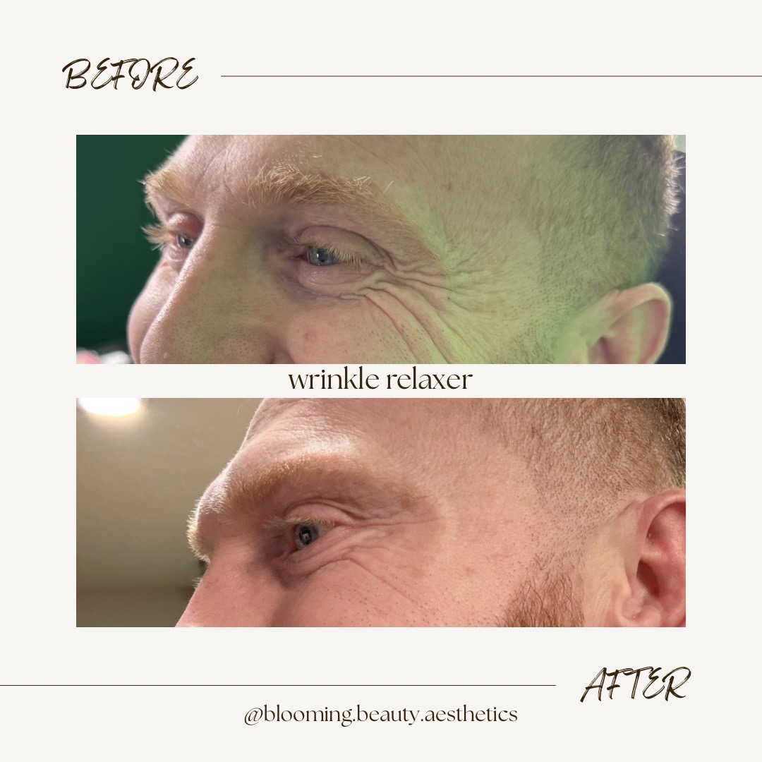 @bloomingbeautyaesthetics