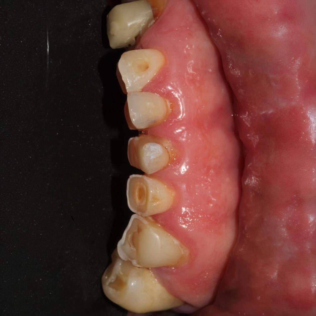 @GabeApreza