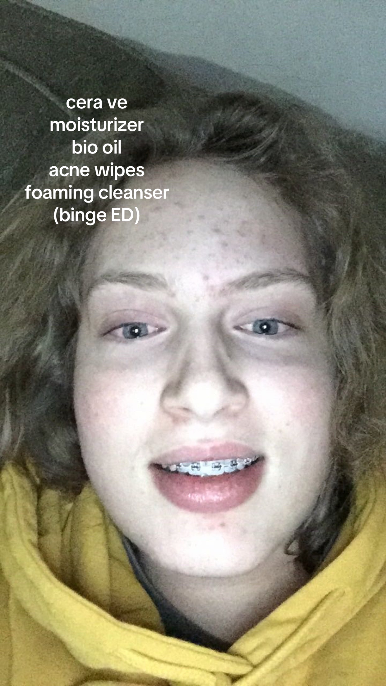 @Baj