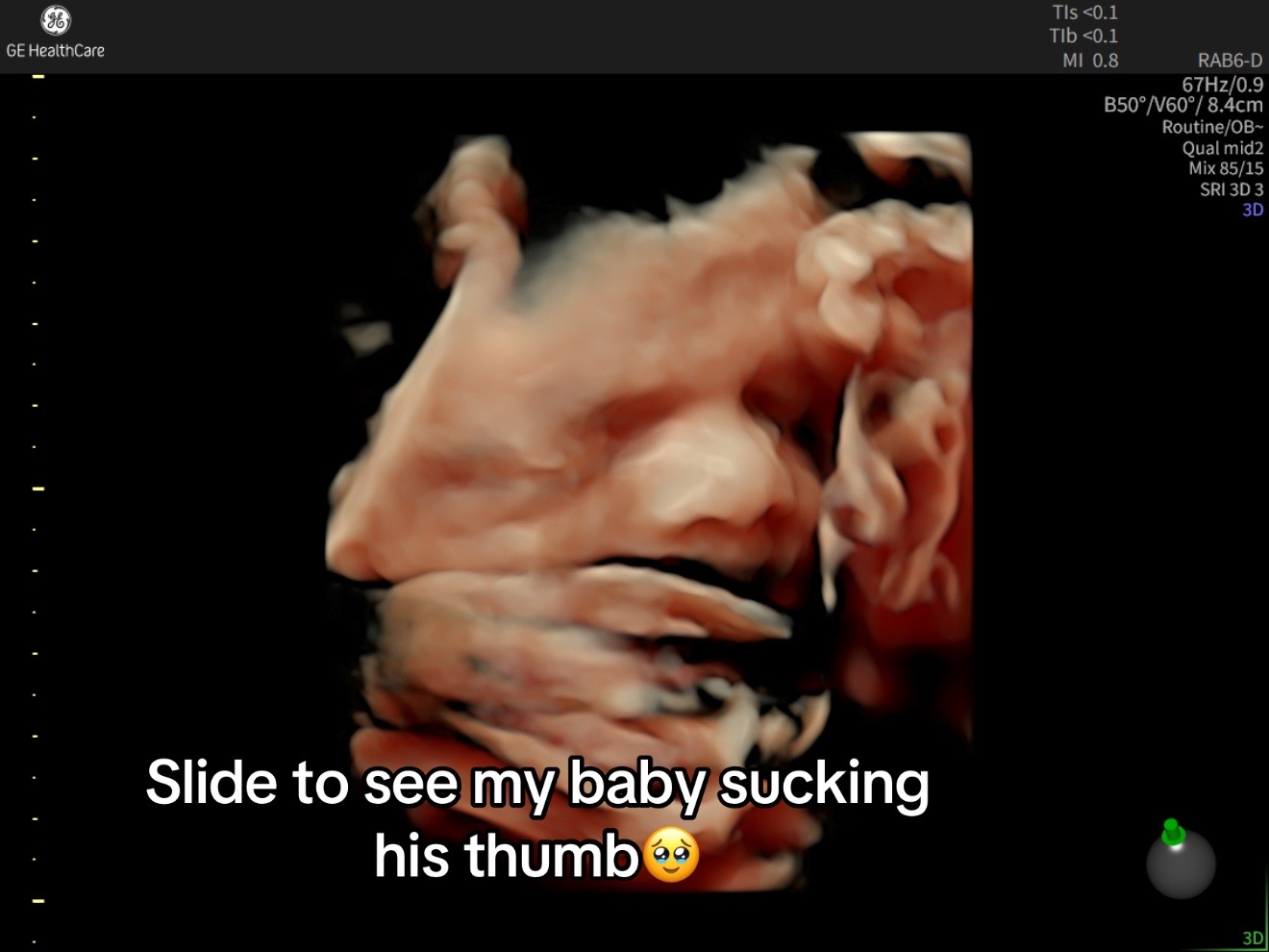 @Cae bby