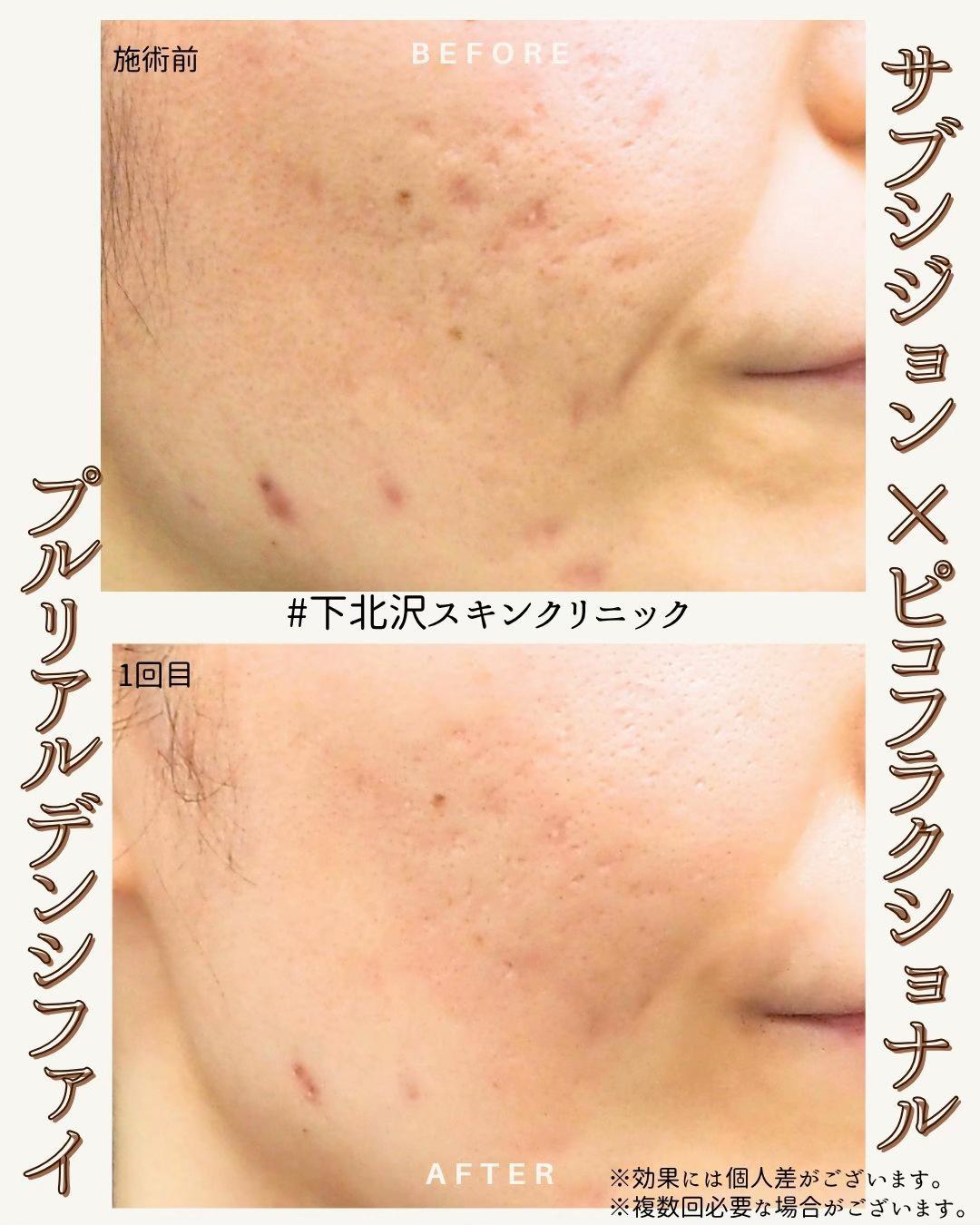 @下北沢スキンクリニック院長・こころの美容外科医・保坂宗孝