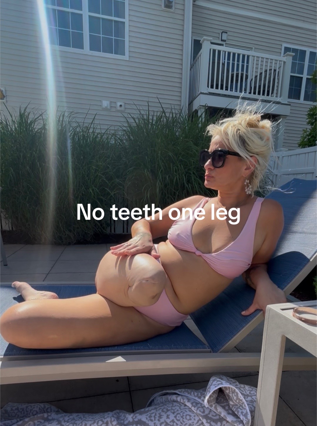@DentureDiaries