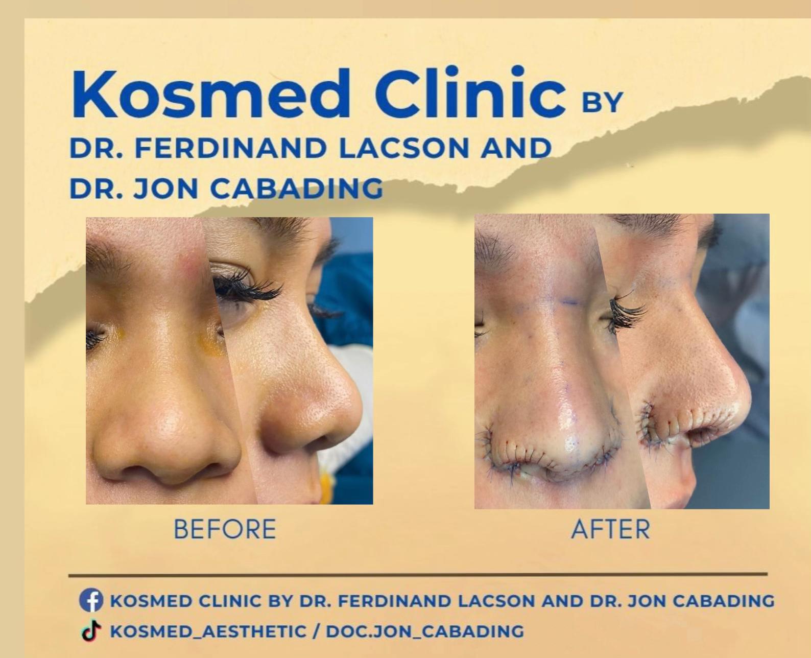 @doc.jon_cabading