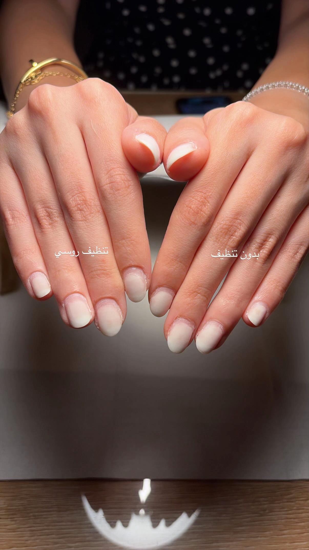 @nailssh4