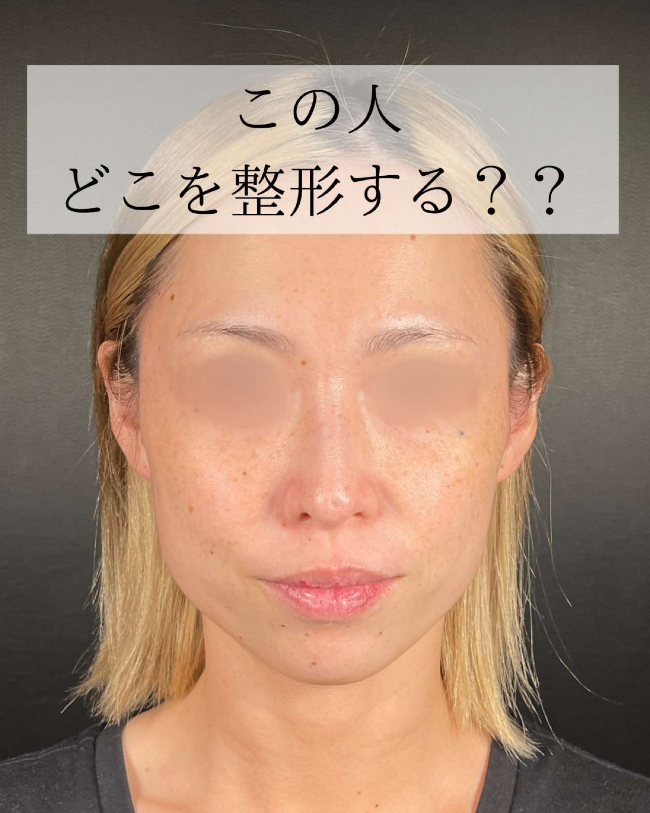 @鼻整形R Beauty CLINIC 副院長👨&zwj;⚕️吉田慧