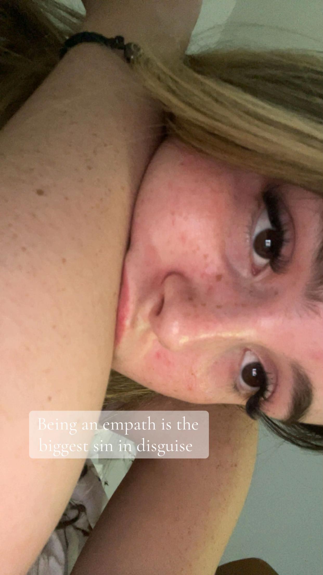 @xleahs.dumpx