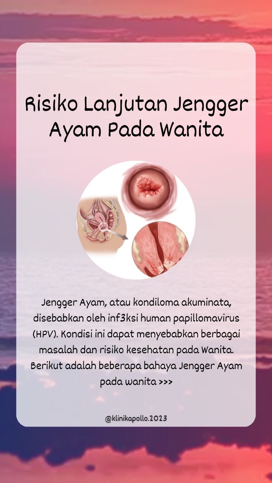 @KLINIK APOLLO JAKARTA
