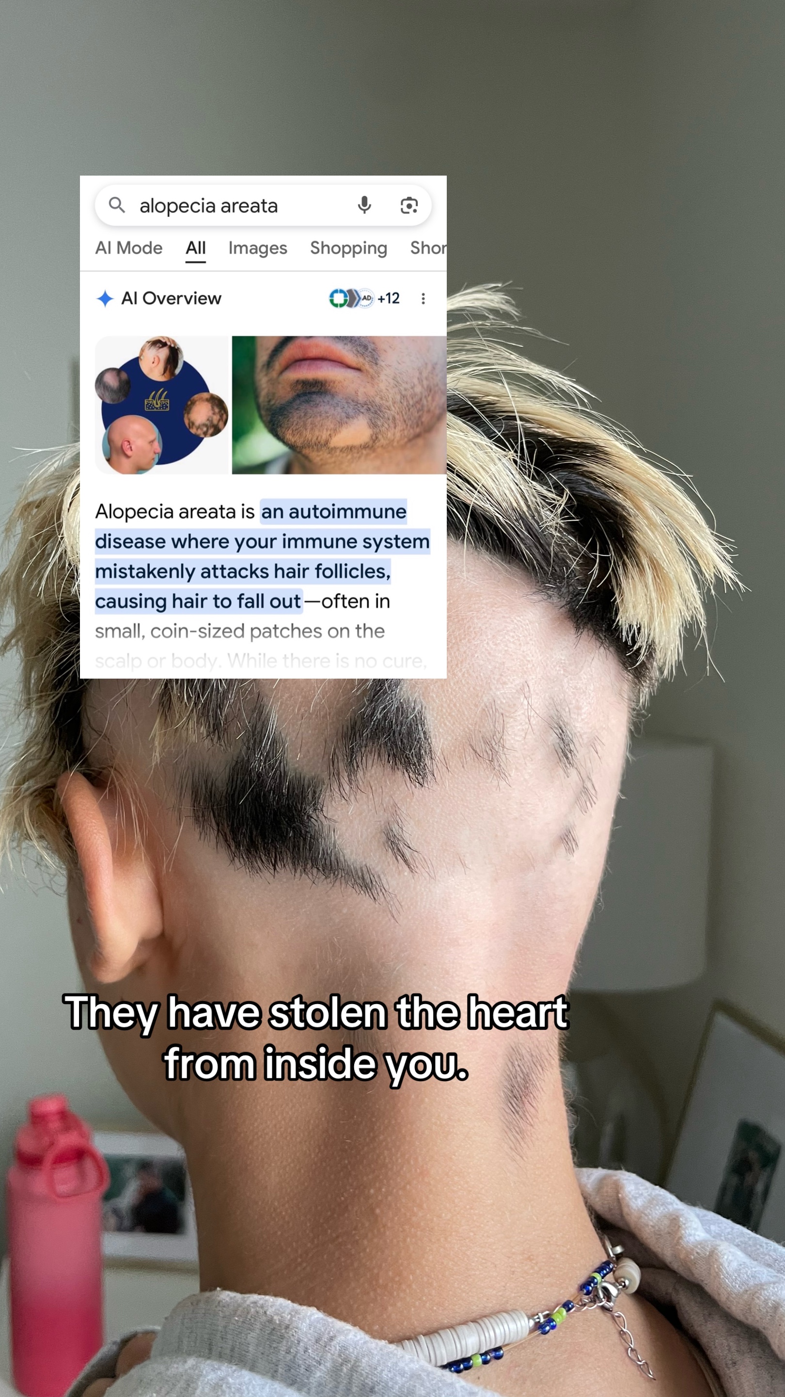 @kalista garr