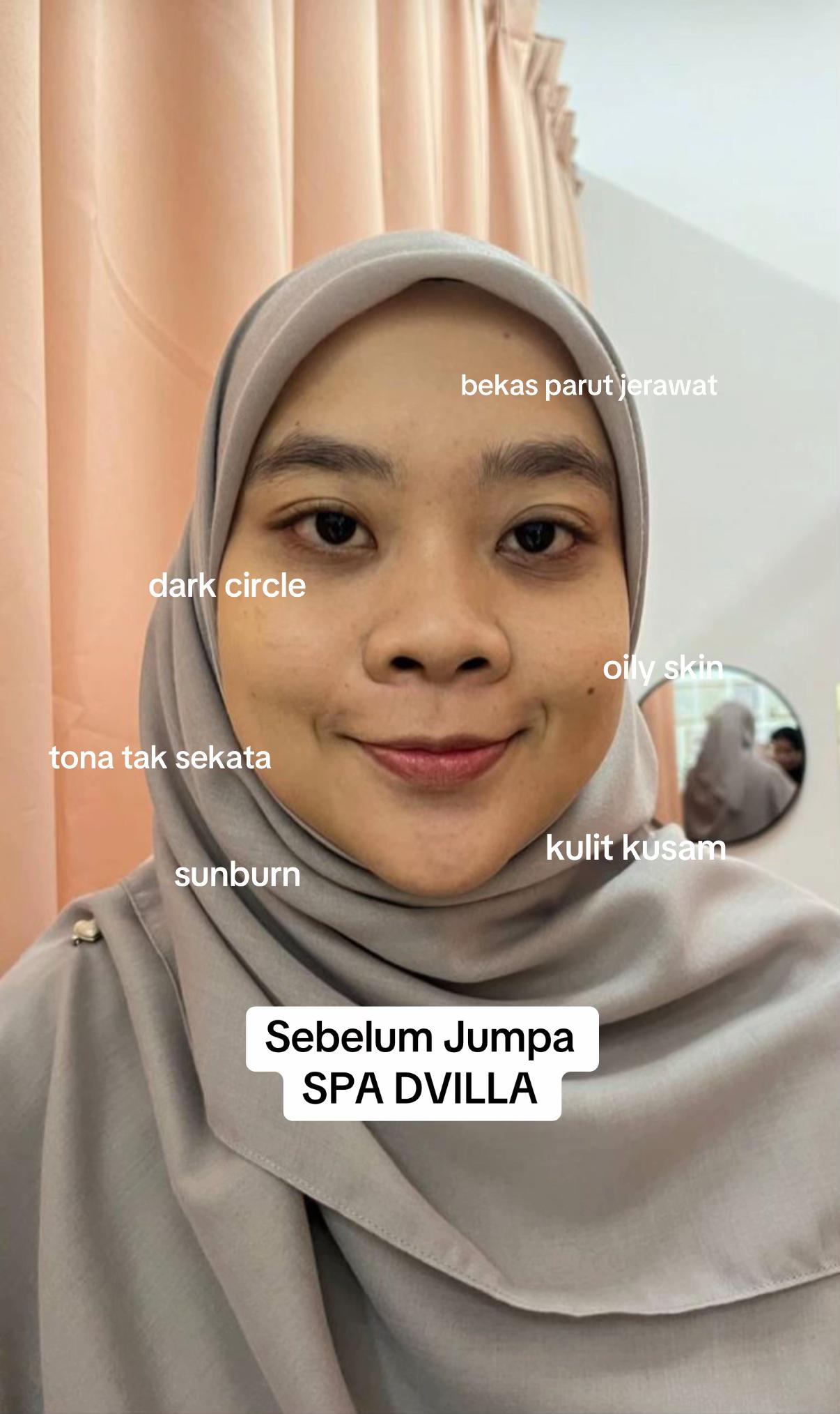 @SPA DVILLA SKIN & SLIM EXPERT