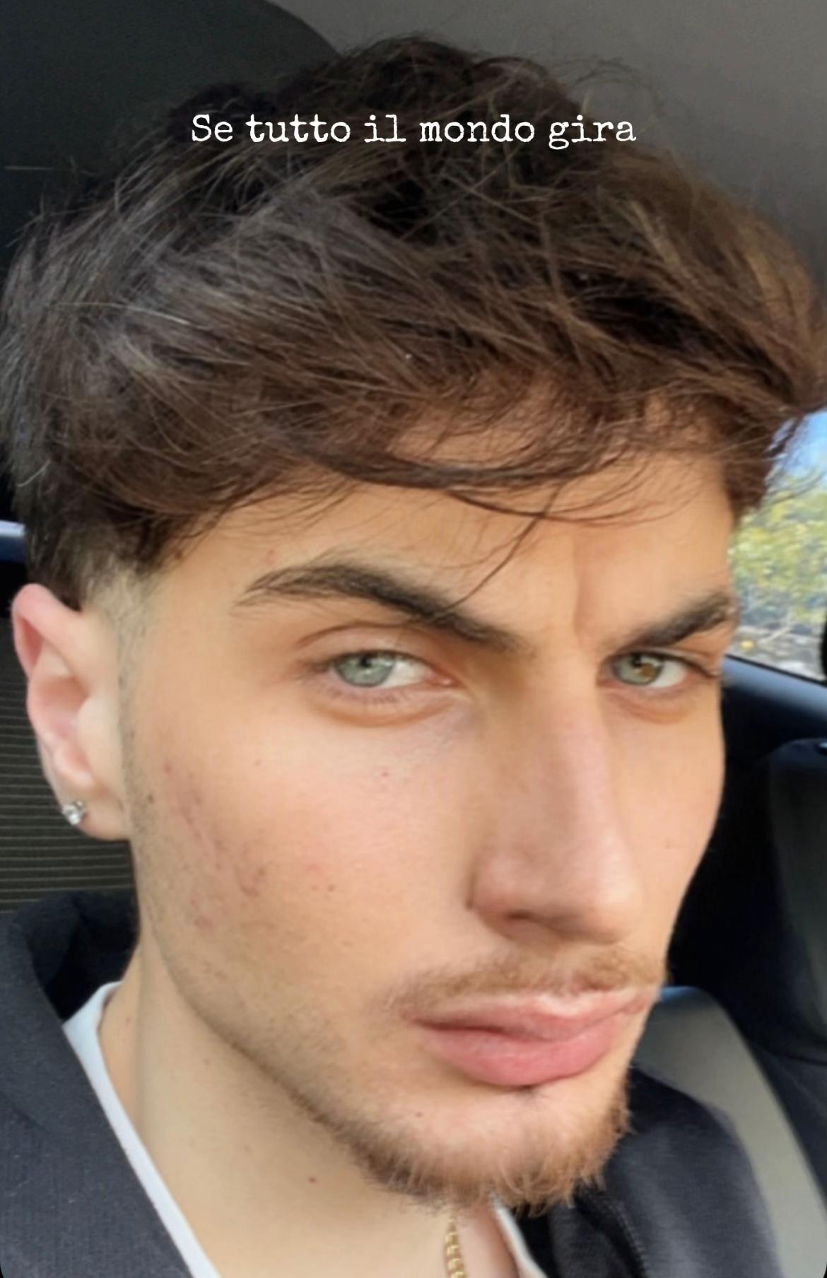 @Daniel Dammiano