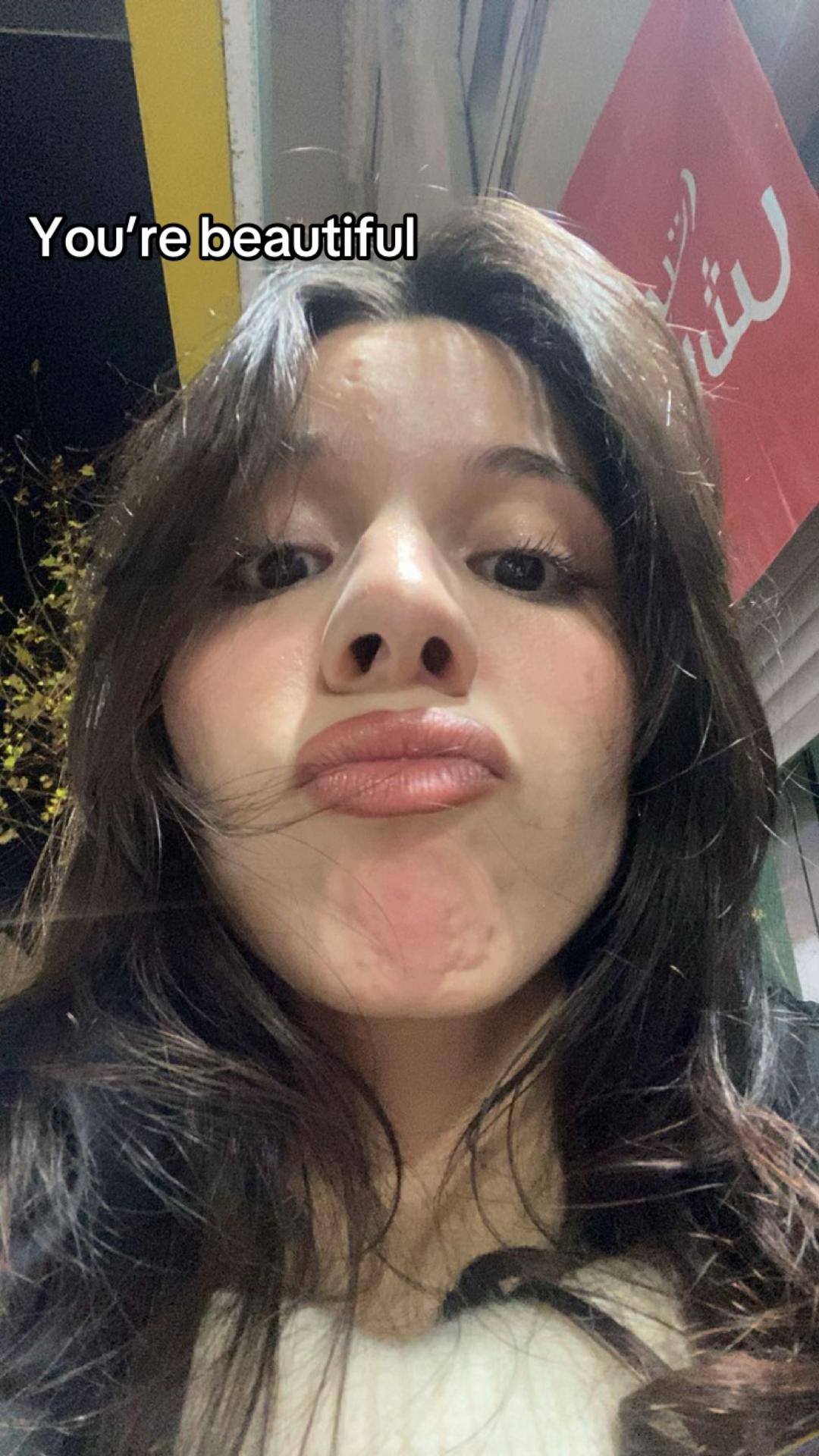 @Youssra