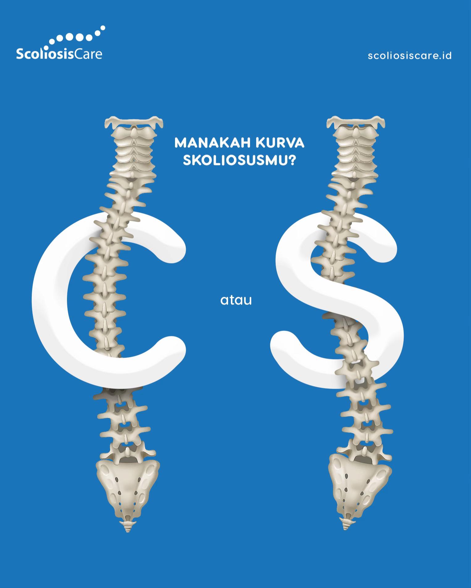 @Scoliosis Care