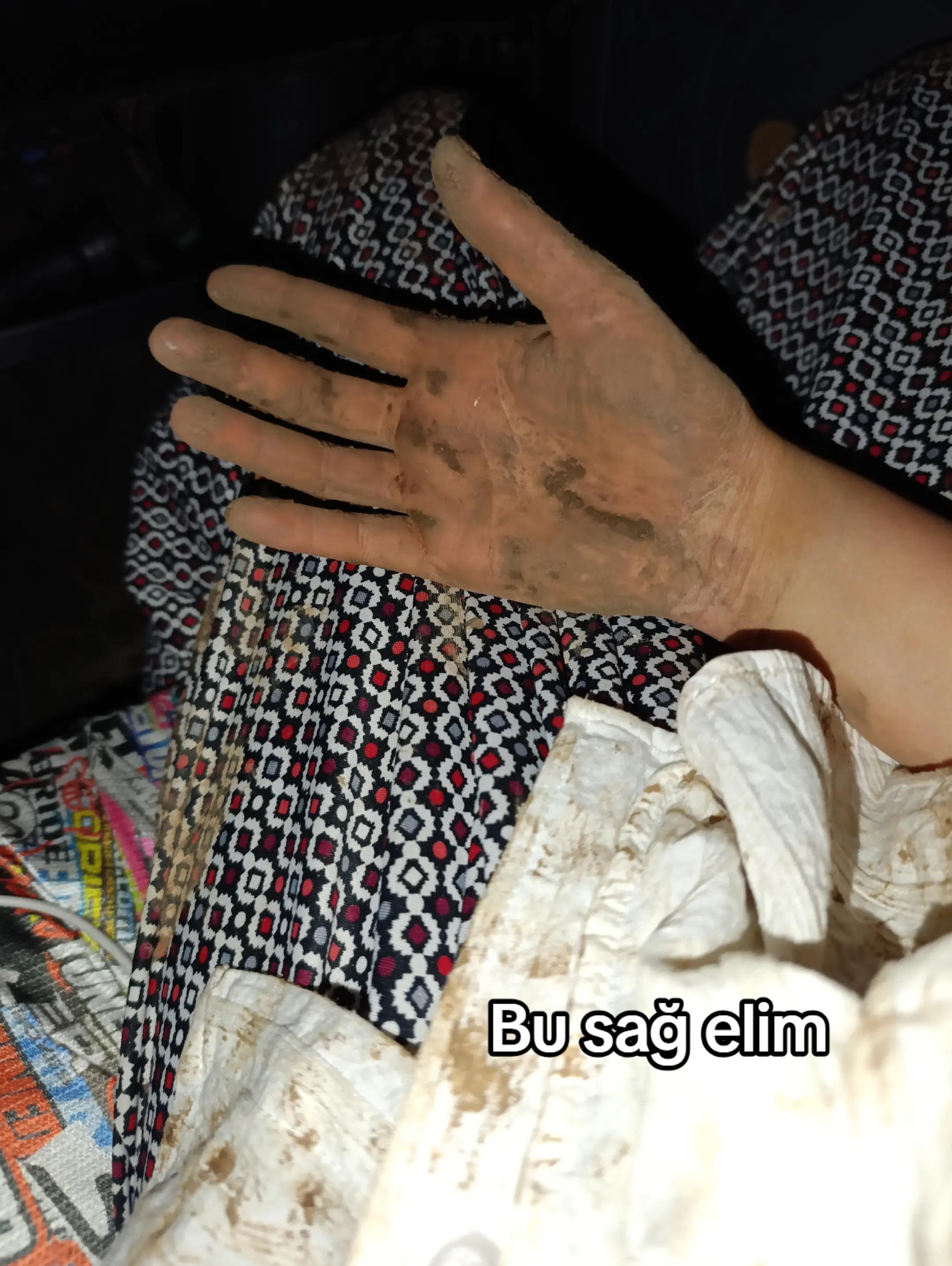 @Teslime AFŞAR