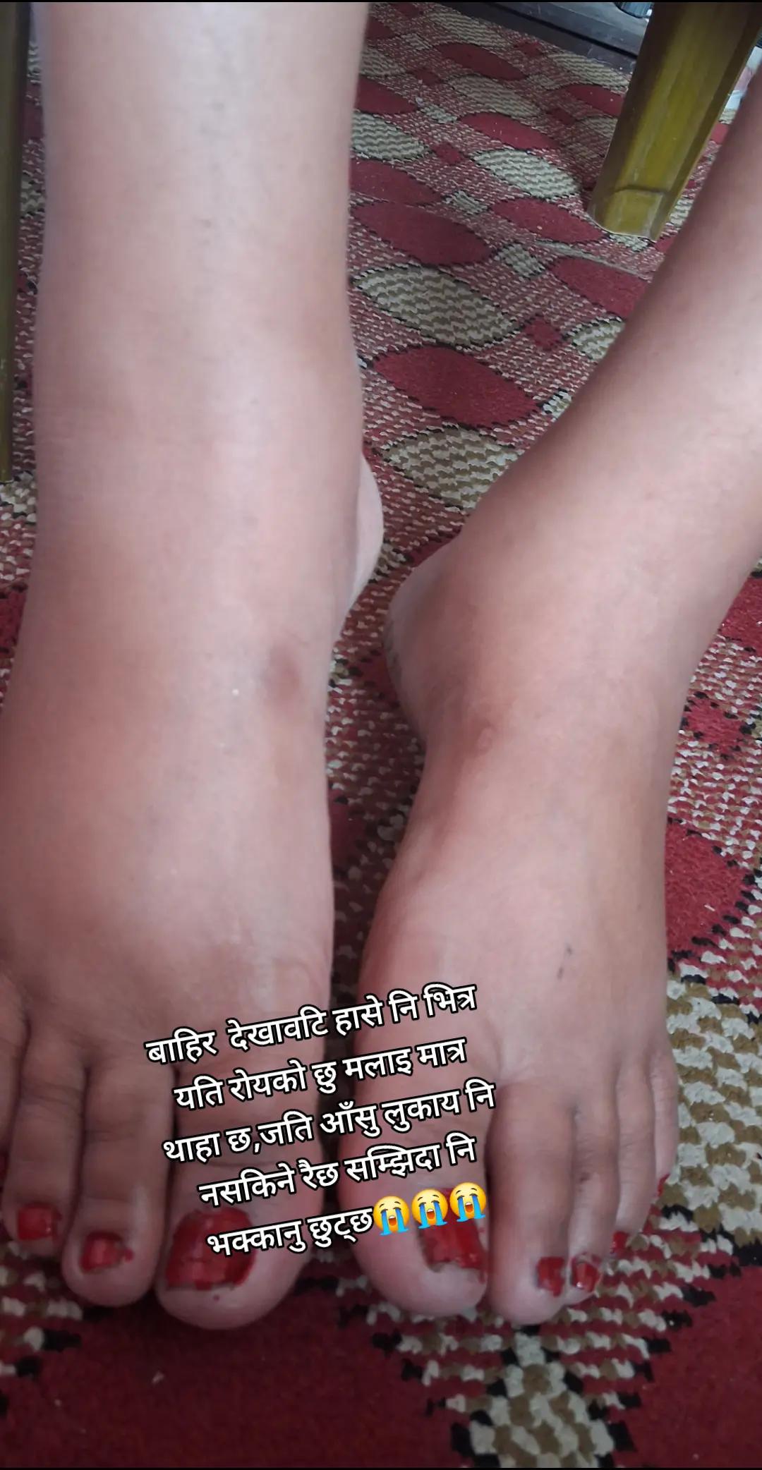@kali saru