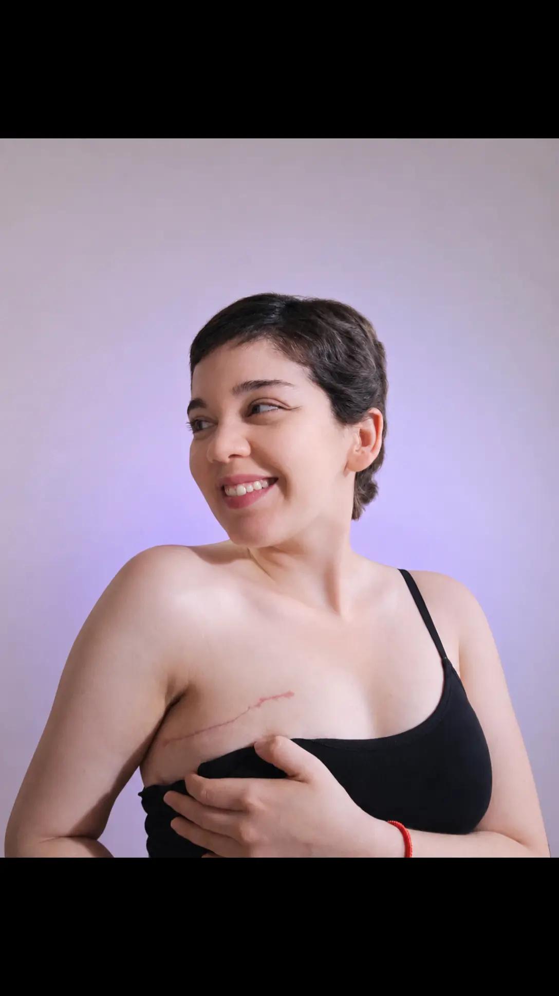 @ale