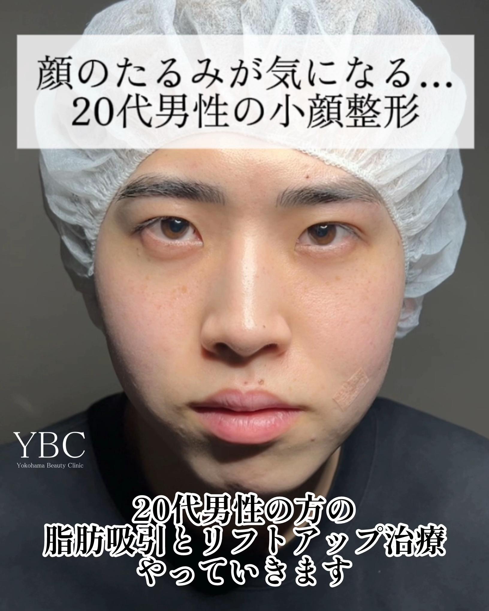 @イソセン/美容外科医（磯村亮輔院長）