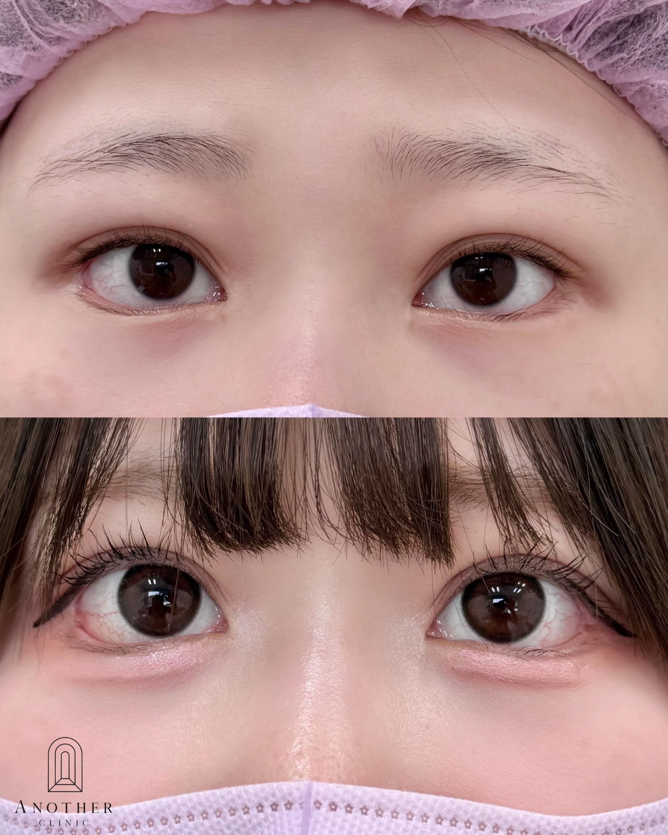 @にしやま先生@目整形専門