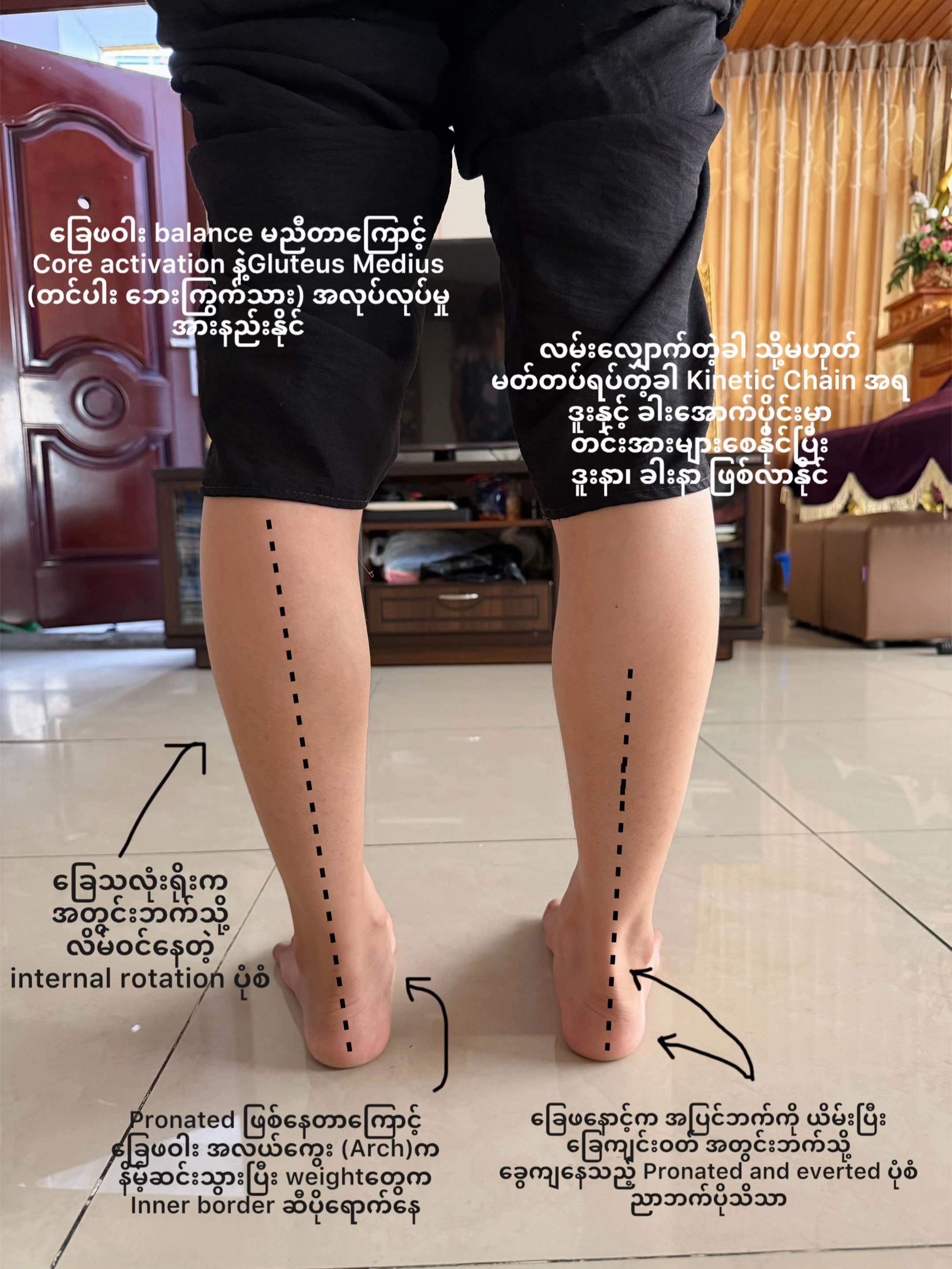 @Hnin Ei Phyu(Tr Mee)