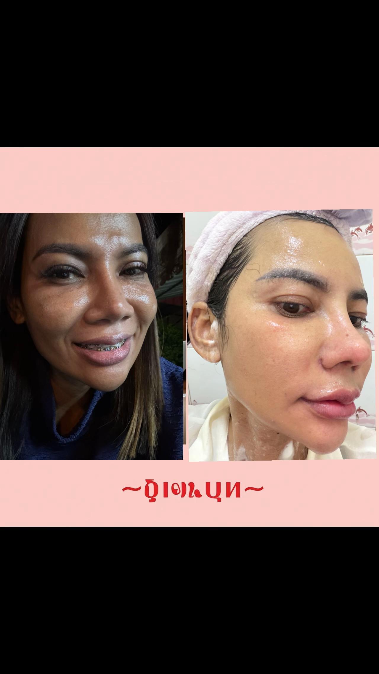 @นัตตี้คือความโชคดี