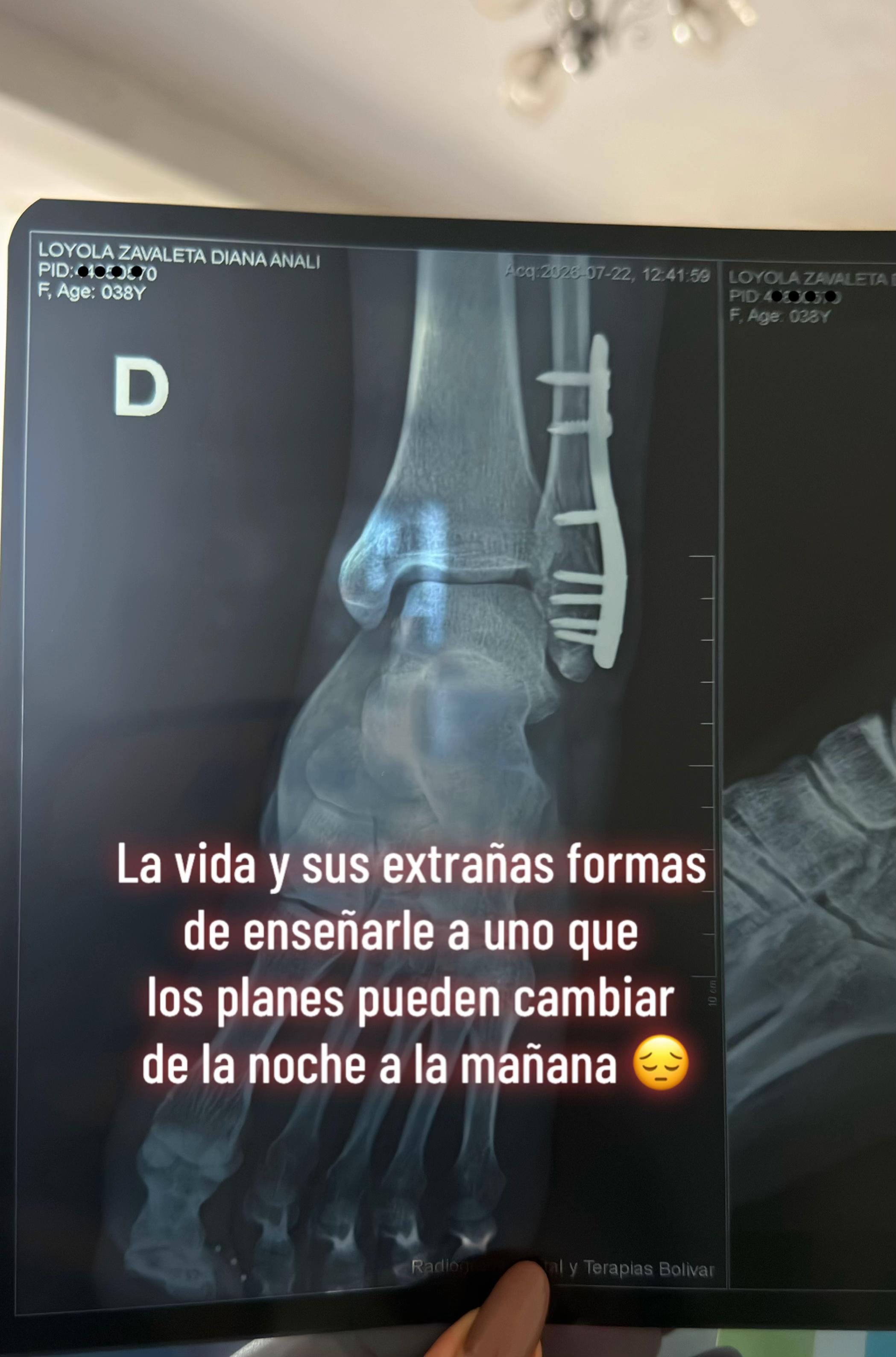 @DIANY