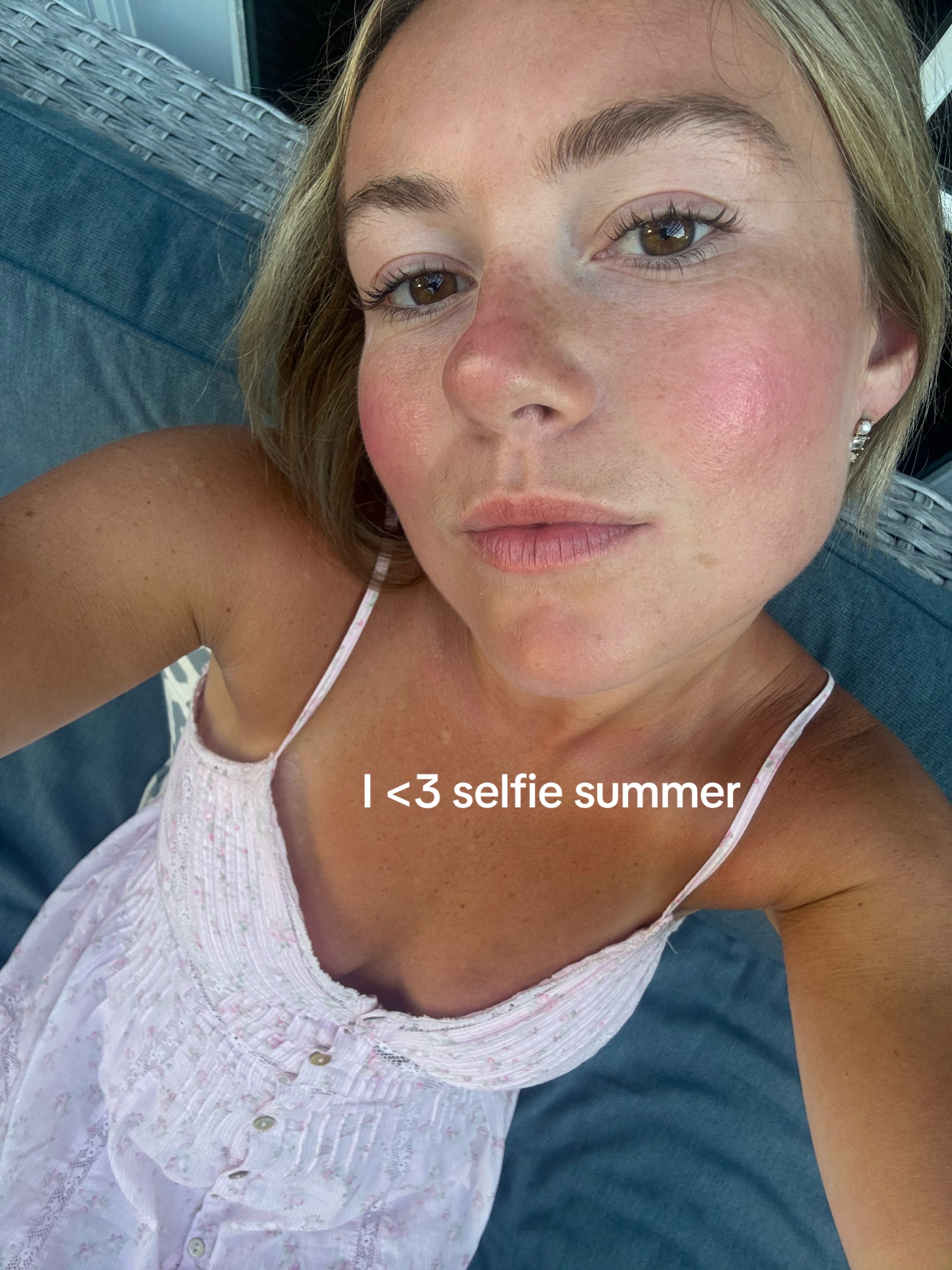 @Skinni