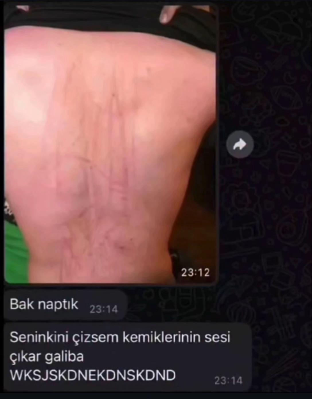 @İg: yagizyzz1