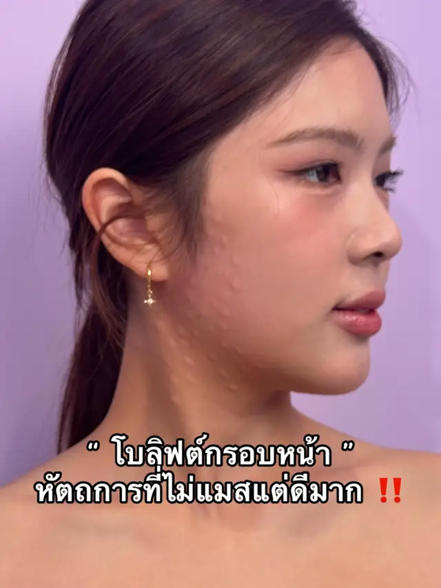@APEXYOUNGCLINIC
