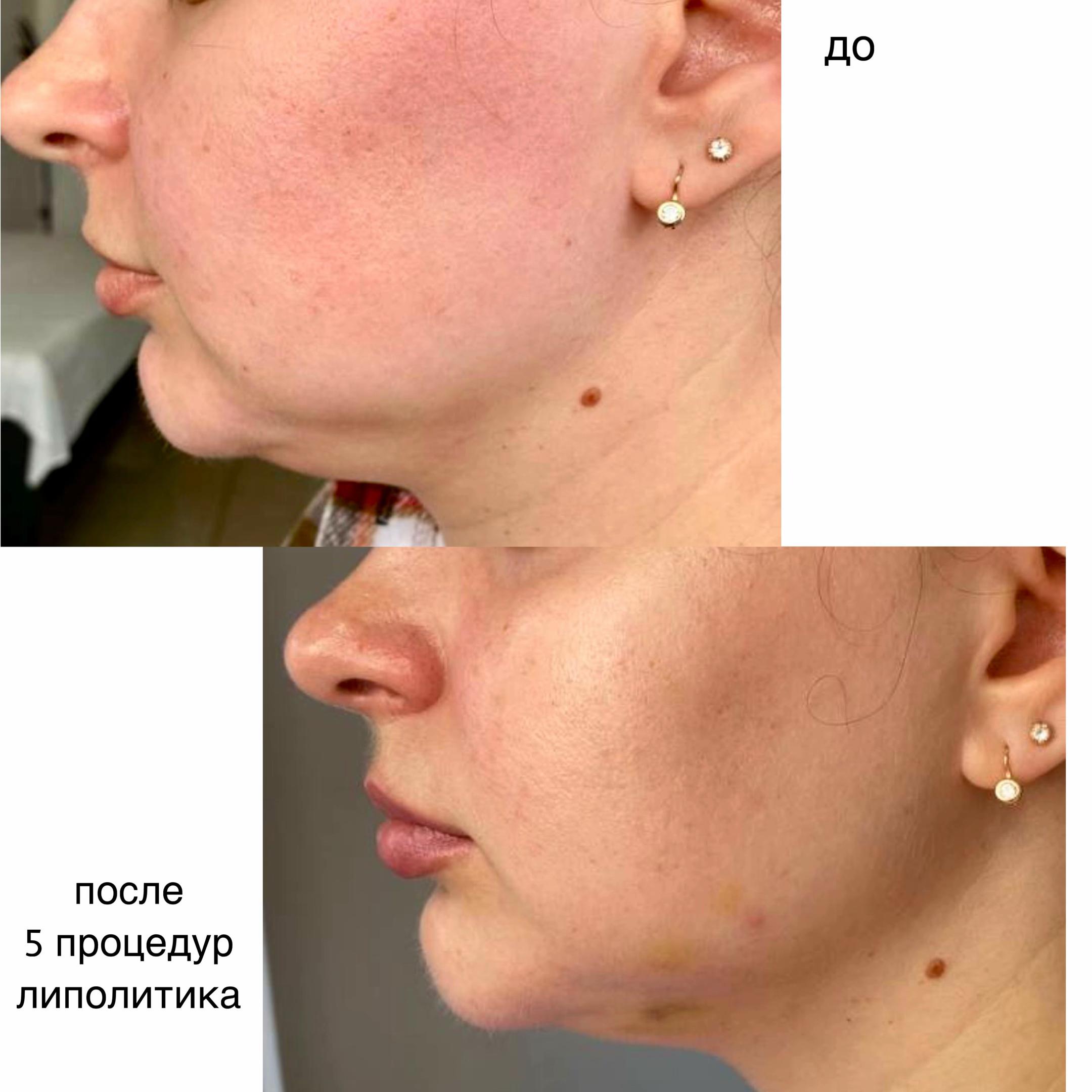 @dr.anush.cosmetolog